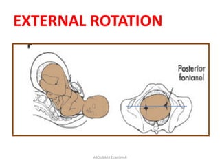 Management of normal labour | PDF