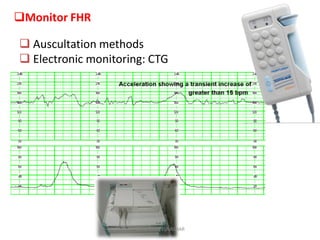 Monitor FHR
 Auscultation methods
 Electronic monitoring: CTG
ABOUBAKR ELNASHAR
 