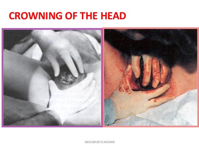 Human Giving Birth Natural Birth Human Giving Birth Natural Birth