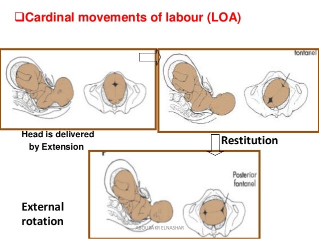 8 mechanisms of labor of normal Management labour