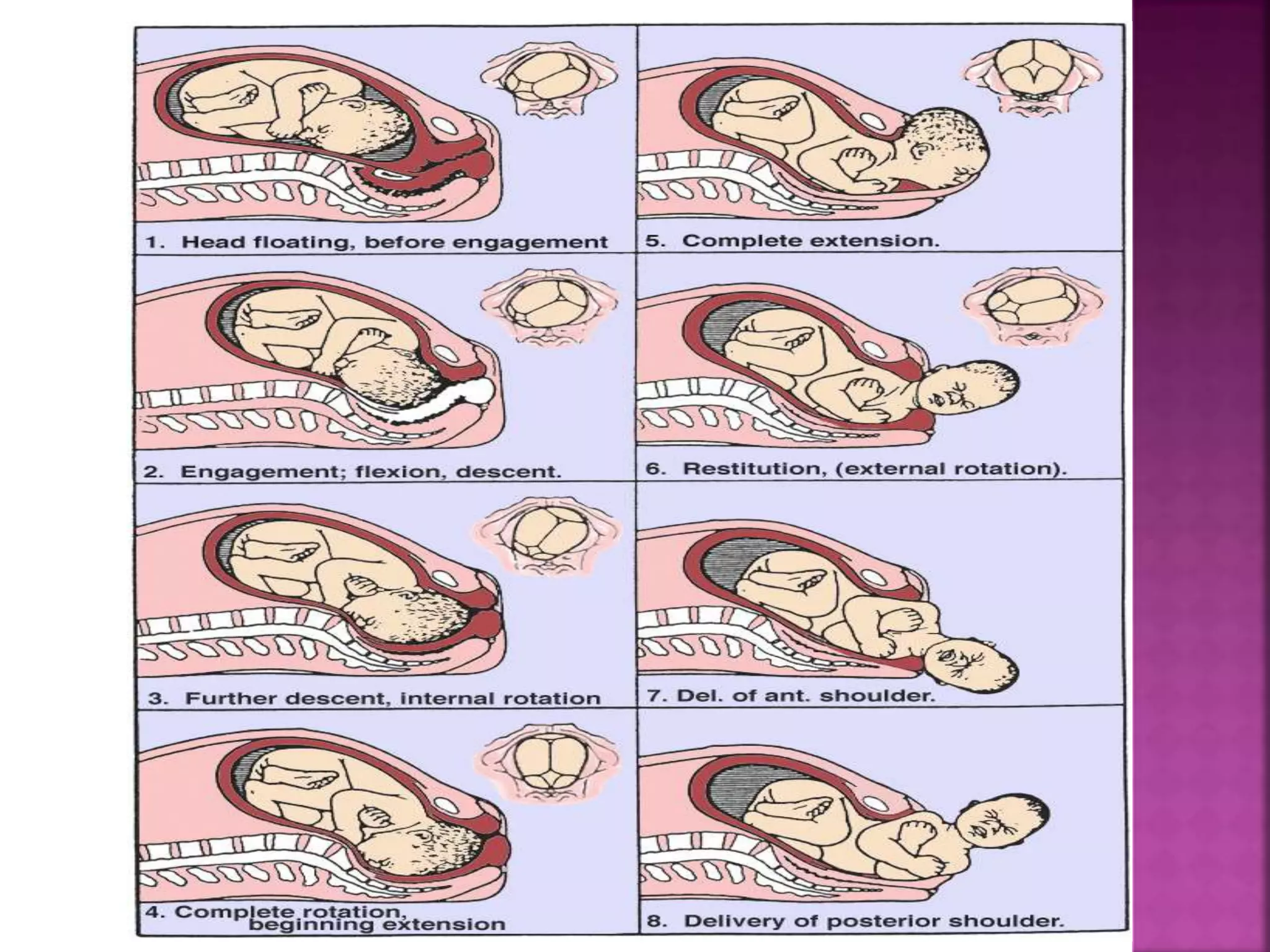 Mechanism of labour ppt