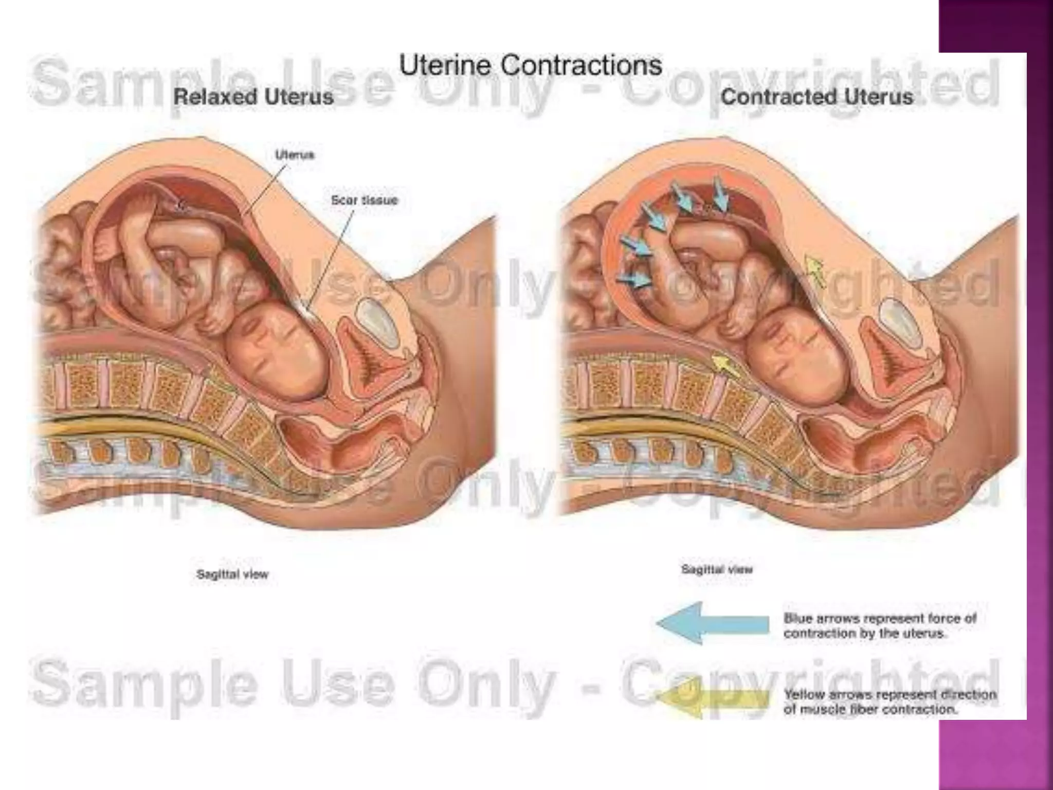 Mechanism of labour ppt