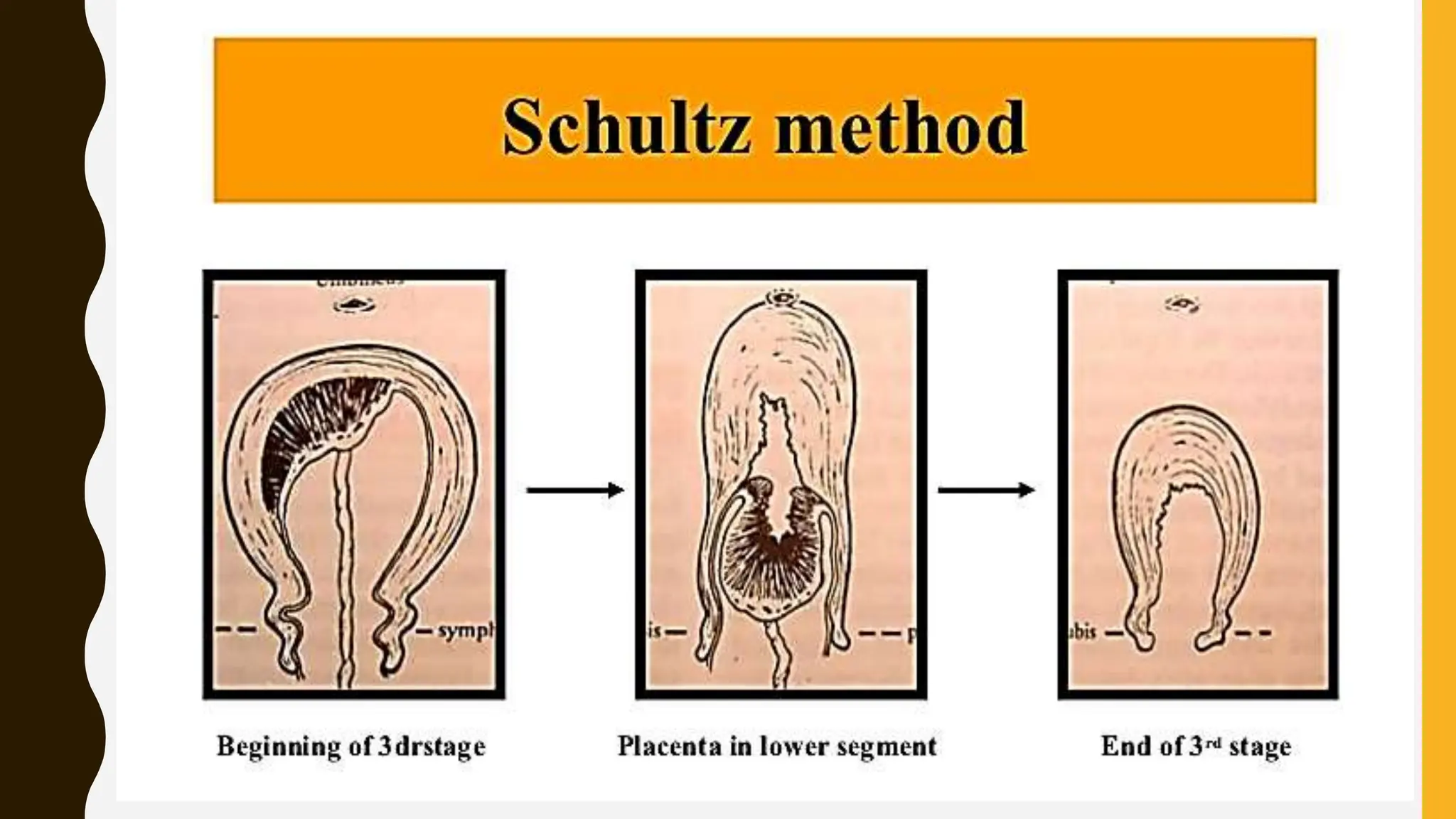 SCHULTZ METHOD
 