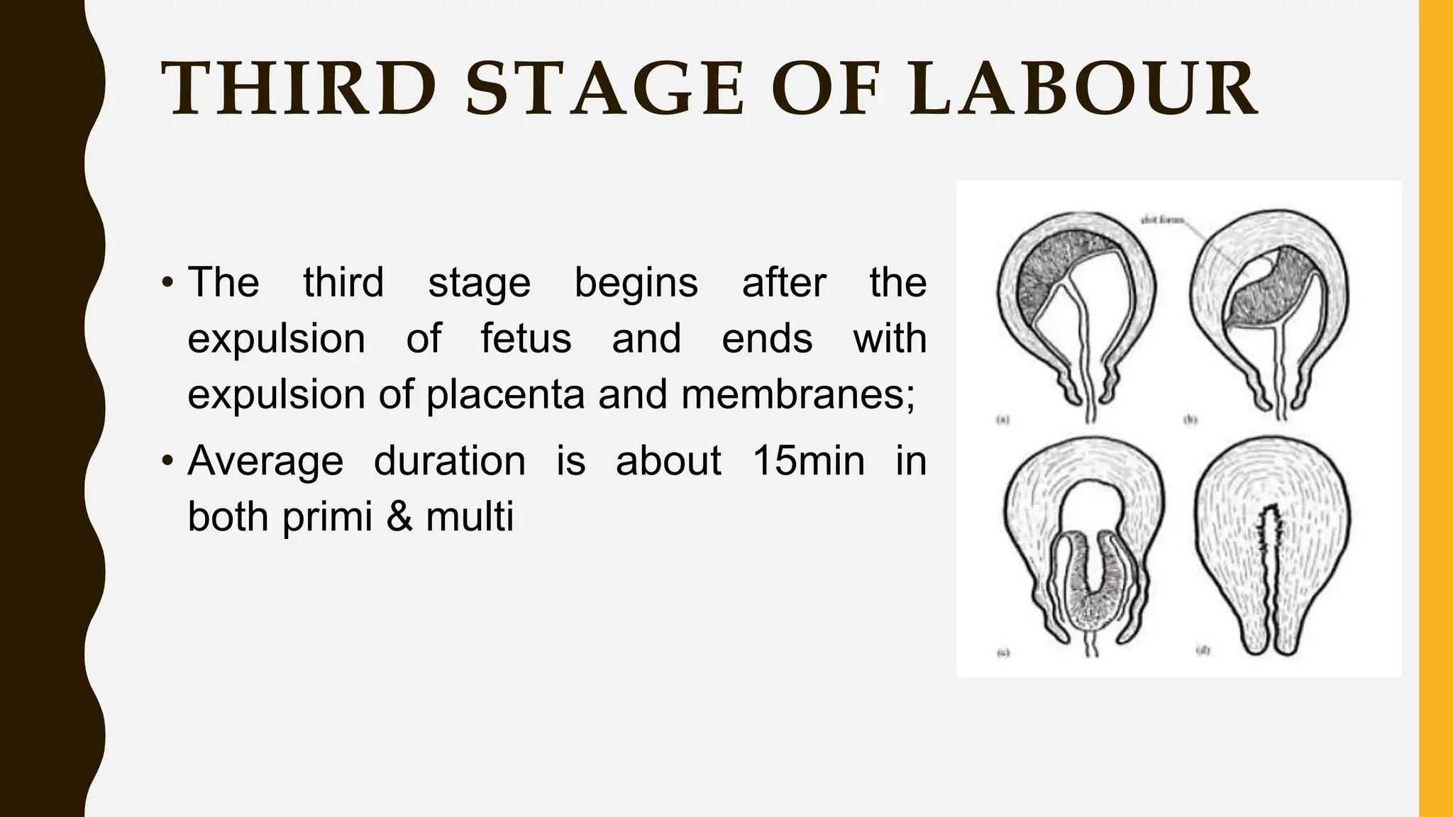 THIRD STAGE OF LABOUR
• The third stage begins after the
expulsion of fetus and ends with
expulsion of placenta and membranes;
• Average duration is about 15min in
both primi & multi
 