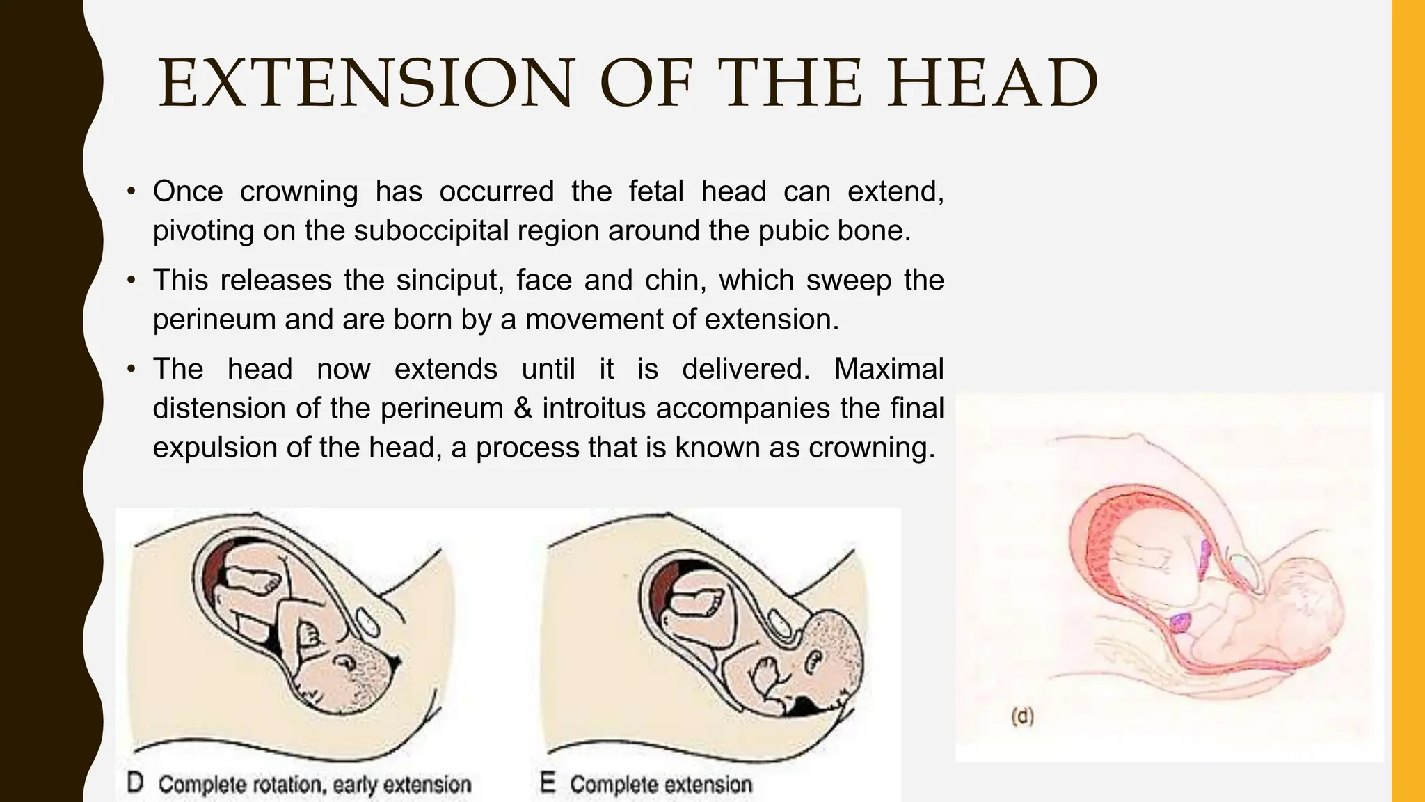 EXTENSION OF THE HEAD
• Once crowning has occurred the fetal head can extend,
pivoting on the suboccipital region around the pubic bone.
• This releases the sinciput, face and chin, which sweep the
perineum and are born by a movement of extension.
• The head now extends until it is delivered. Maximal
distension of the perineum & introitus accompanies the final
expulsion of the head, a process that is known as crowning.
 