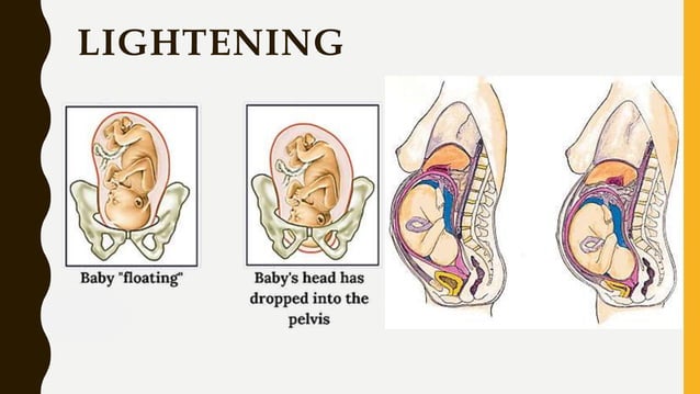 In Labour Labour, Stages and its Physiology in obg | PPT | Pregnancy ...