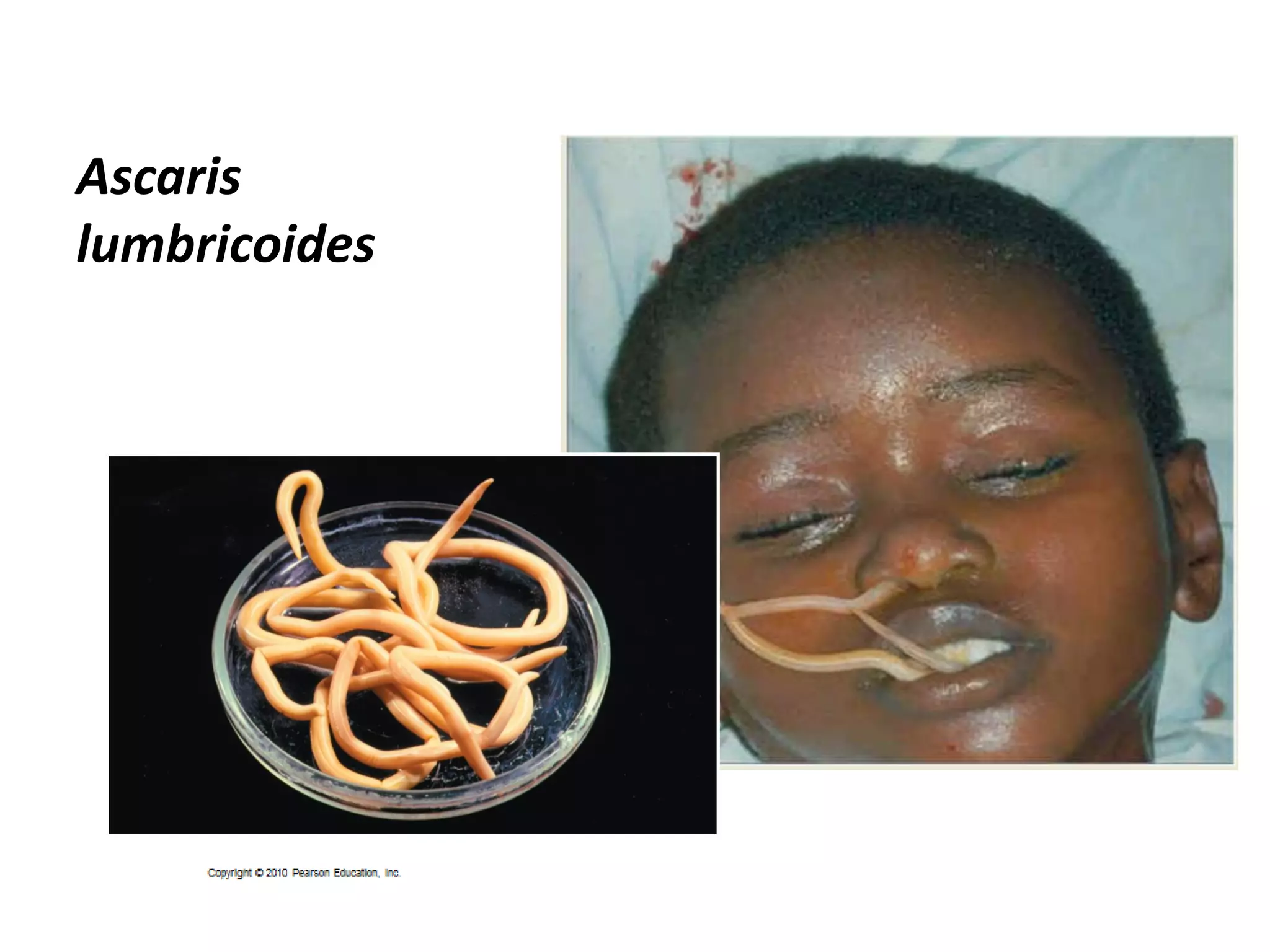 Ascaris
lumbricoides
 