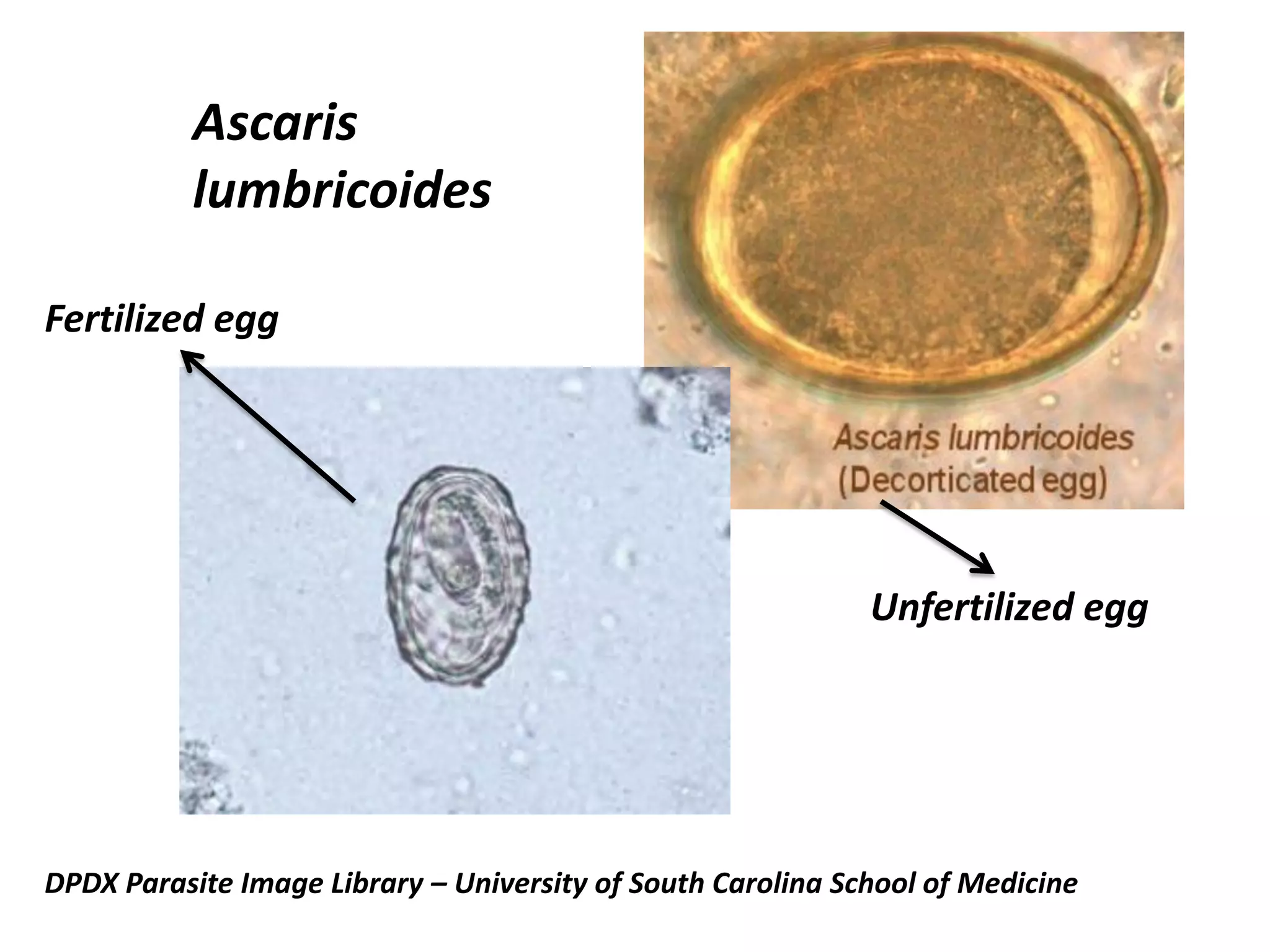 Ascaris
lumbricoides
Unfertilized egg
Fertilized egg
DPDX Parasite Image Library – University of South Carolina School of Medicine
 