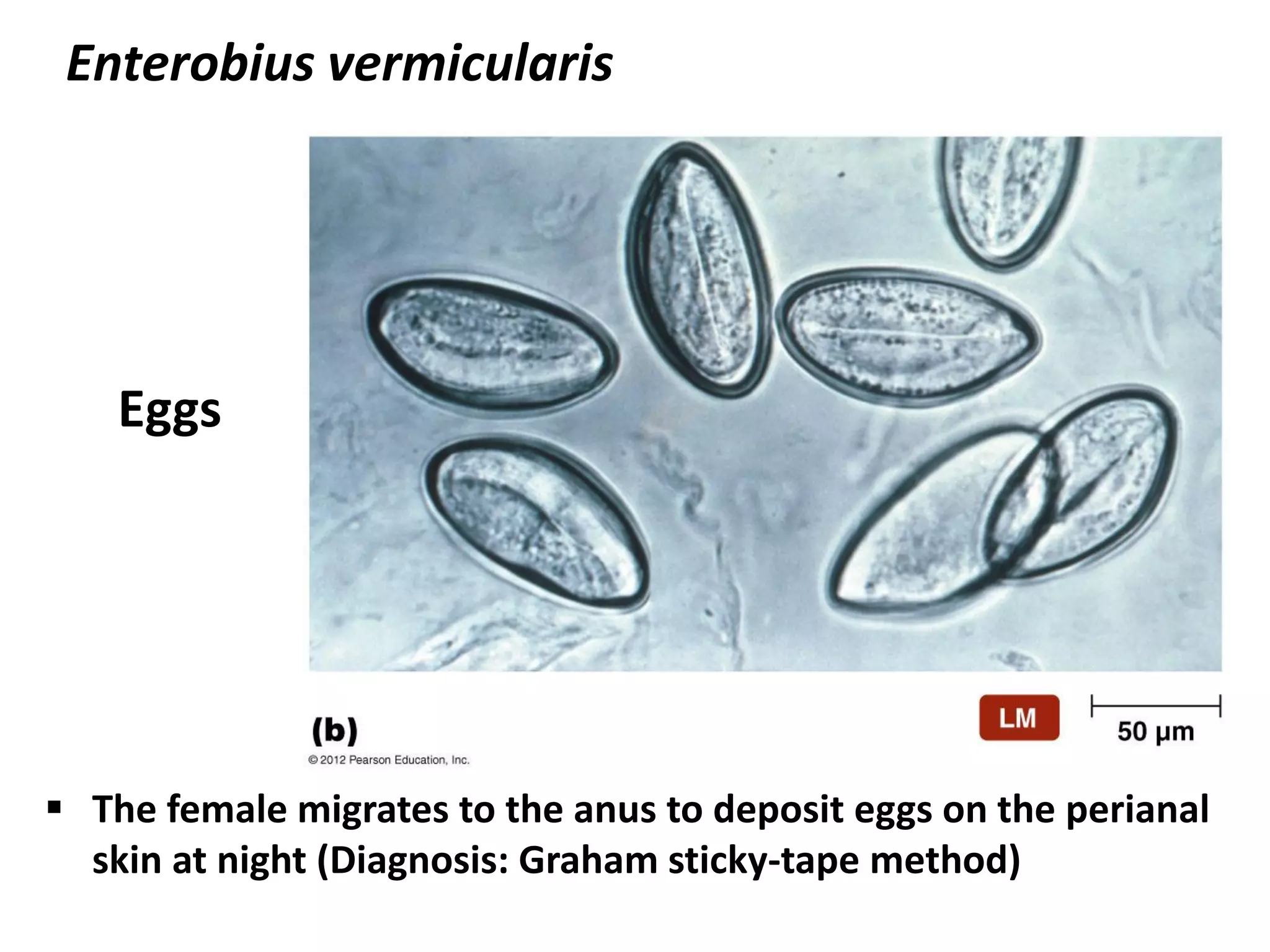Enterobius vermicularis
Eggs
 The female migrates to the anus to deposit eggs on the perianal
skin at night (Diagnosis: Graham sticky-tape method)
 
