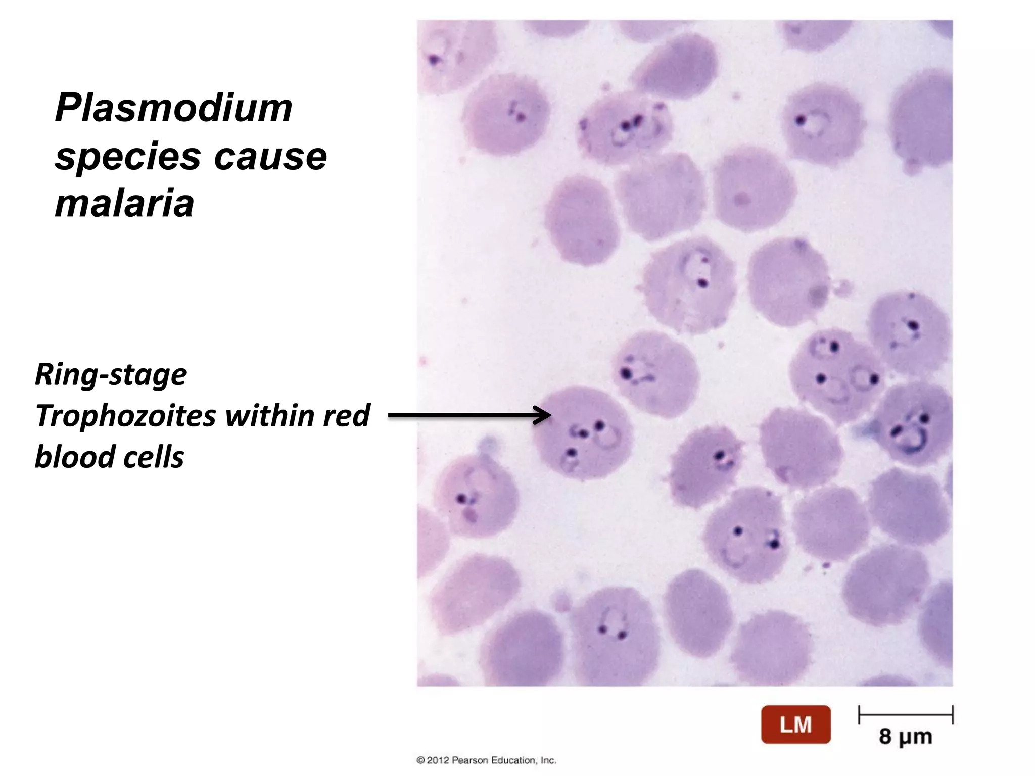 Plasmodium
species cause
malaria
Ring-stage
Trophozoites within red
blood cells
 