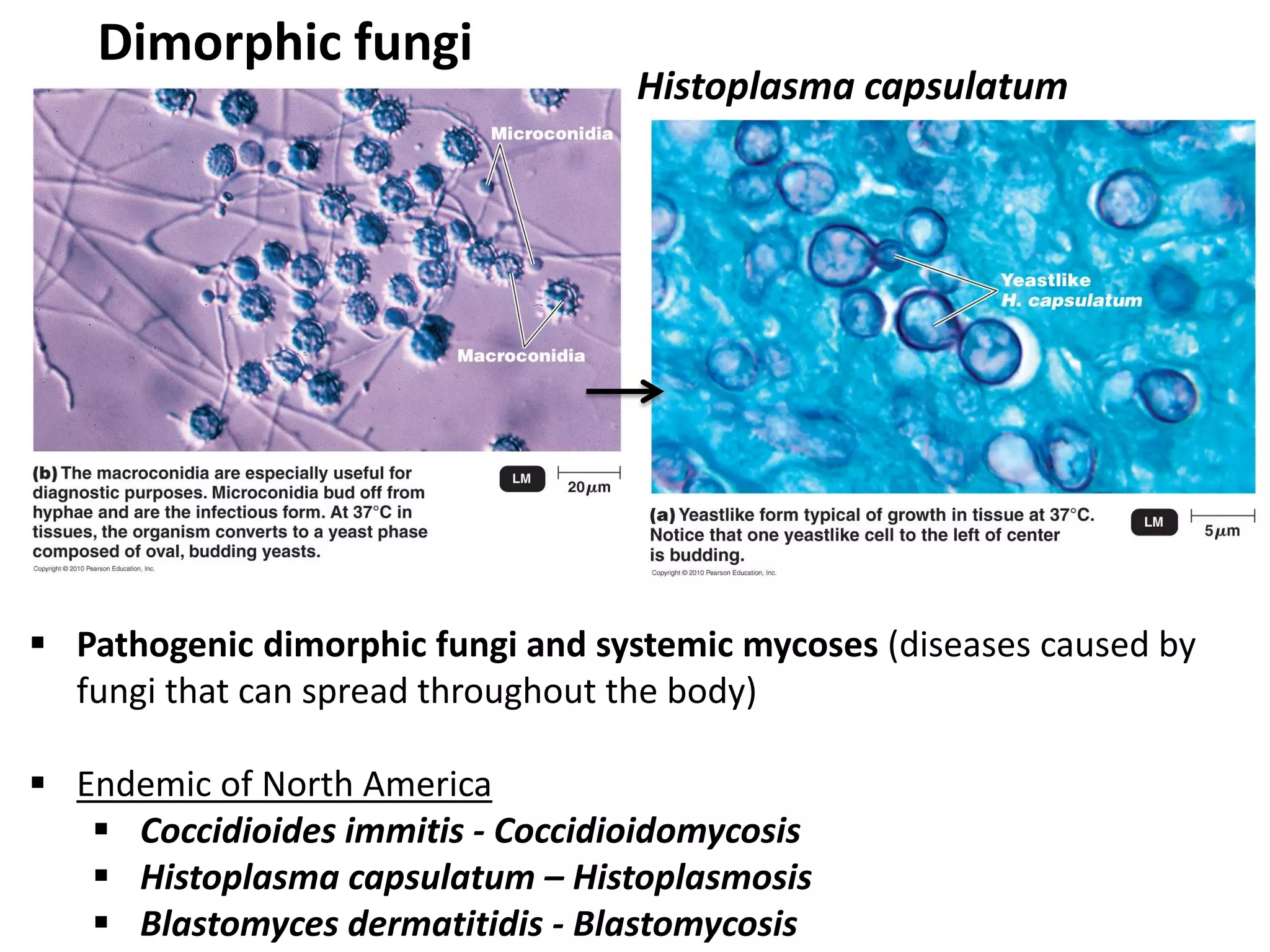 Dimorphic fungi
Histoplasma capsulatum
 Pathogenic dimorphic fungi and systemic mycoses (diseases caused by
fungi that can spread throughout the body)
 Endemic of North America
 Coccidioides immitis - Coccidioidomycosis
 Histoplasma capsulatum – Histoplasmosis
 Blastomyces dermatitidis - Blastomycosis
 