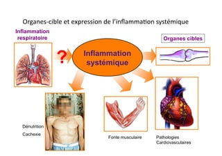 Organes-­‐cible	
  et	
  expression	
  de	
  l’inﬂammaFon	
  systémique	
  
Inflammation
respiratoire	

 Organes cibles	

Inflammation
systémique	

?	

Agusti et al, ERJ 2003	

Pathologies
Cardiovasculaires
Dénutrition
Cachexie
Fonte musculaire
Ostéoporose
 