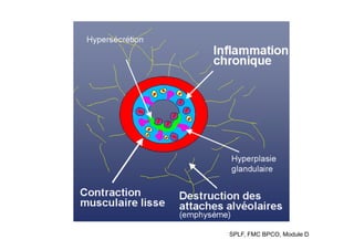 SPLF, FMC BPCO, Module D
 