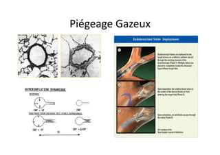 Piégeage	
  Gazeux	
  
 