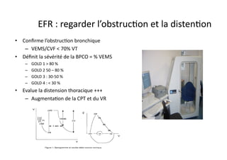  EFR	
  :	
  regarder	
  l’obstrucFon	
  et	
  la	
  distenFon	
  
•  Conﬁrme	
  l’obstrucFon	
  bronchique	
  
–  VEMS/CVF	
  <	
  70%	
  VT	
  
•  Déﬁnit	
  la	
  sévérité	
  de	
  la	
  BPCO	
  =	
  %	
  VEMS	
  
–  GOLD	
  1	
  >	
  80	
  %	
  
–  GOLD	
  2	
  50	
  –	
  80	
  %	
  
–  GOLD	
  3	
  :	
  30-­‐50	
  %	
  
–  GOLD	
  4	
  :	
  <	
  30	
  %	
  
•  Evalue	
  la	
  distension	
  thoracique	
  +++	
  
–  AugmentaFon	
  de	
  la	
  CPT	
  et	
  du	
  VR	
  
 