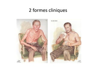 2	
  formes	
  cliniques	
  
 