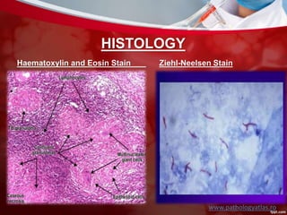 HISTOLOGY
Haematoxylin and Eosin Stain Ziehl-Neelsen Stain
www.pathologyatlas.ro
 