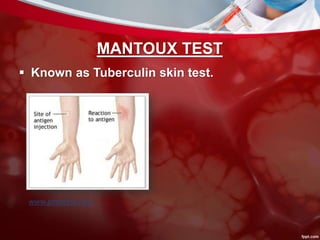 MANTOUX TEST
 Known as Tuberculin skin test.
www.pinterest.com
 