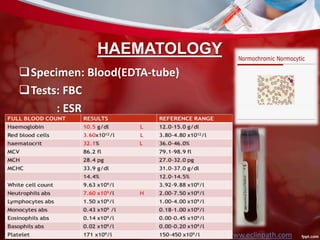 HAEMATOLOGY
Specimen: Blood(EDTA-tube)
Tests: FBC
: ESR
www.eclinpath.com
 