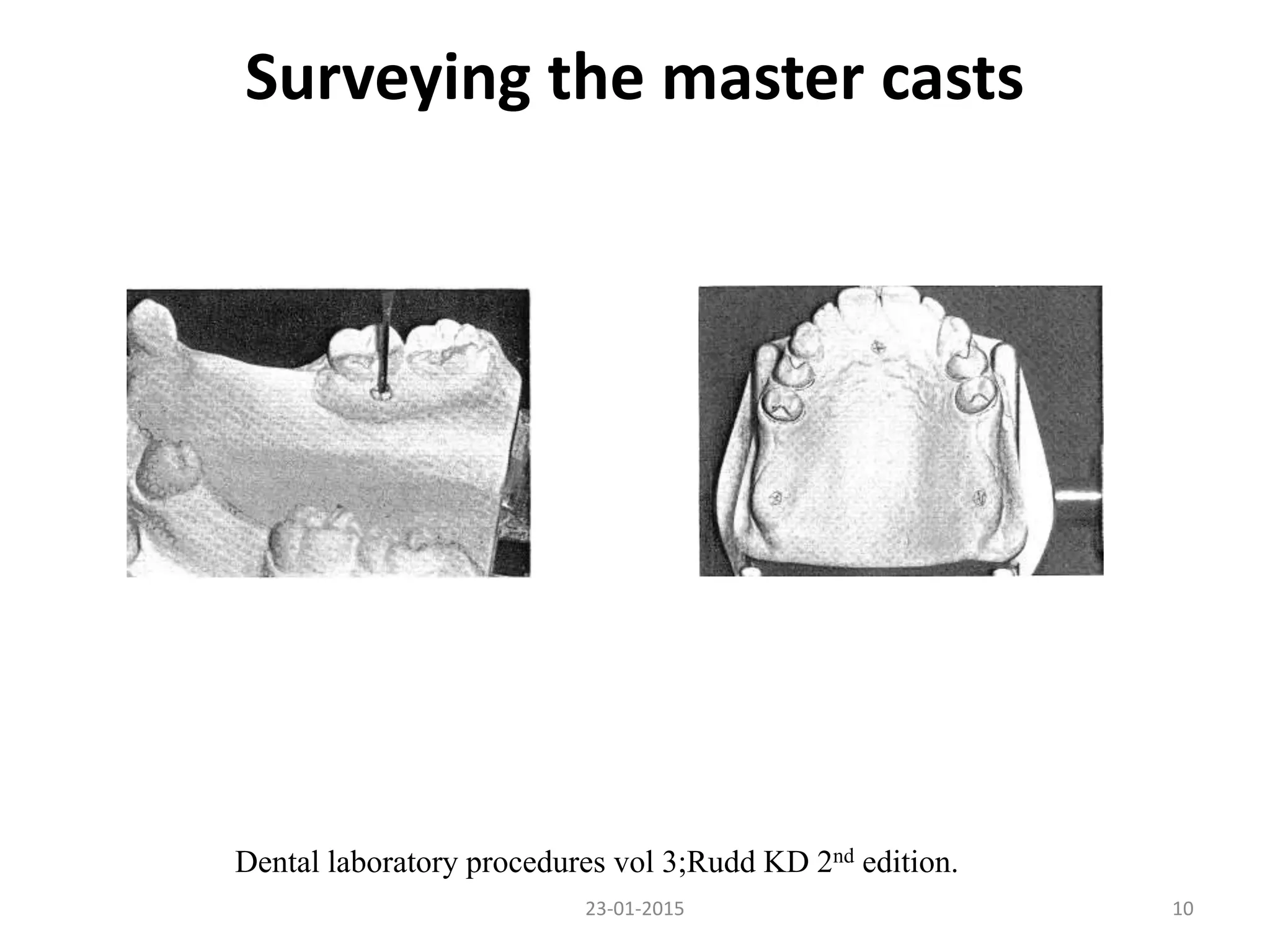 23-01-2015 10
Surveying the master casts
Dental laboratory procedures vol 3;Rudd KD 2nd edition.
 
