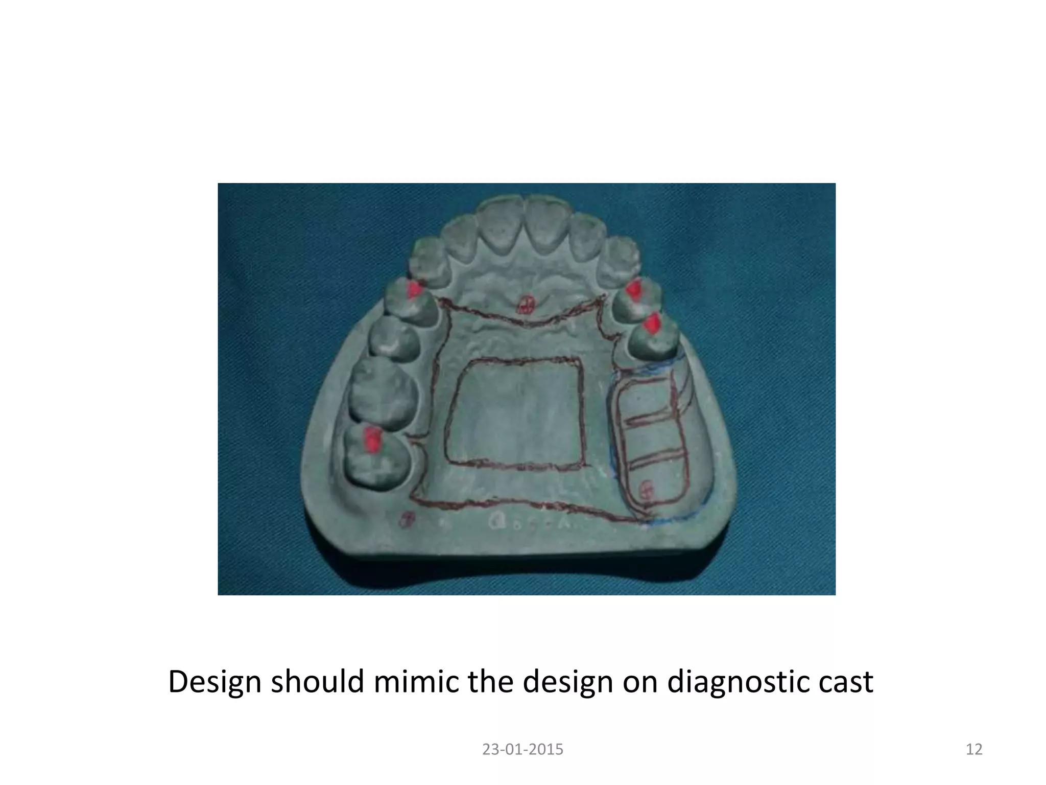 23-01-2015 12
Design should mimic the design on diagnostic cast
 