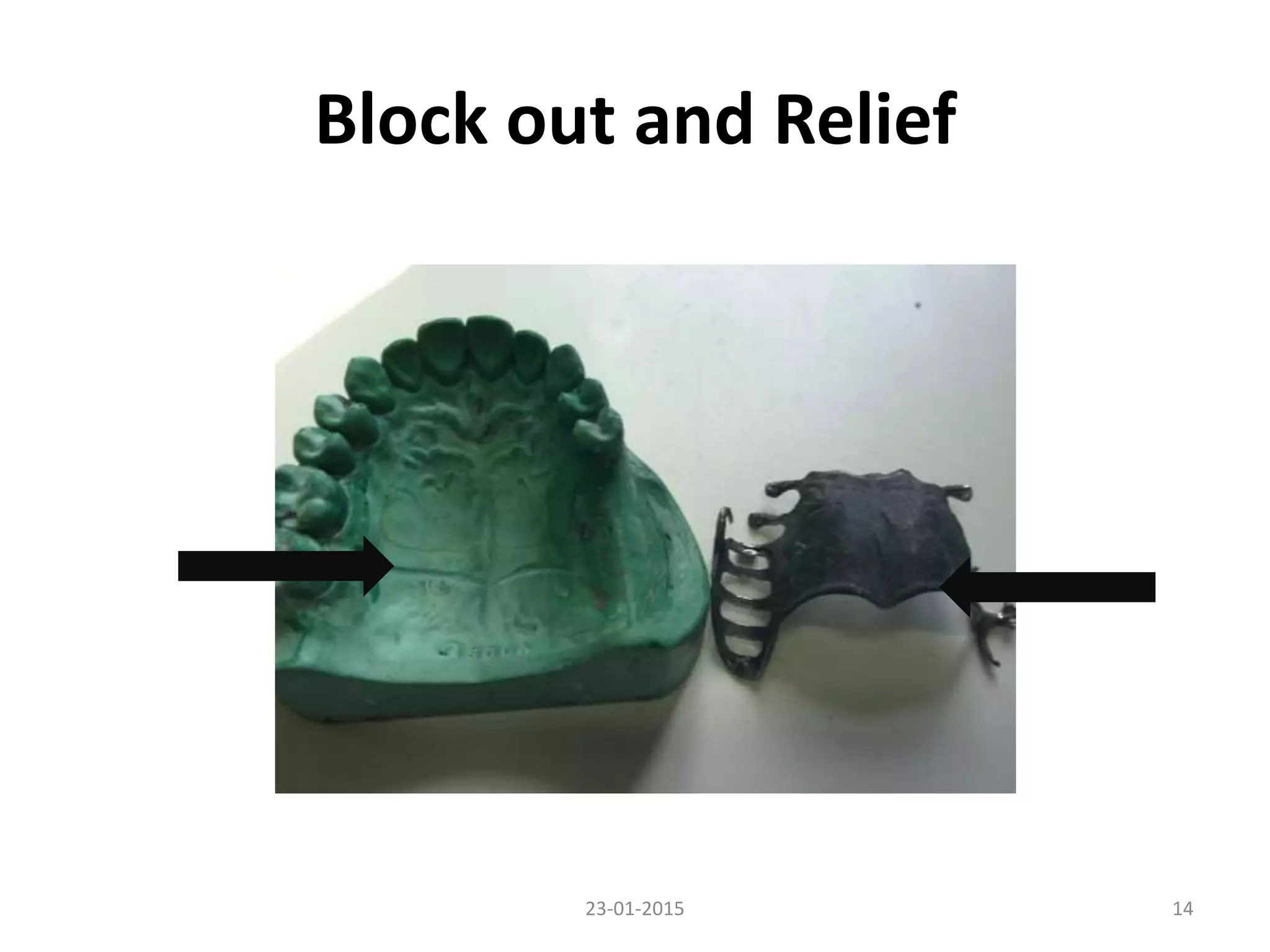 Block out and Relief
1423-01-2015
 
