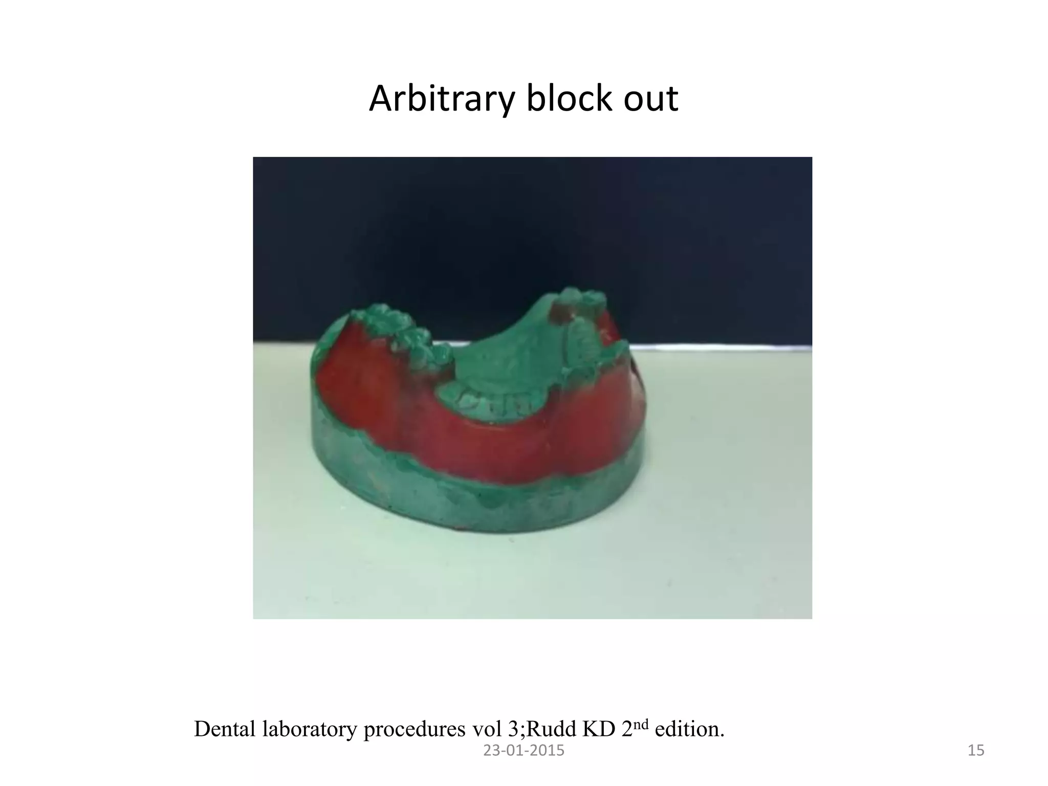 Arbitrary block out
1523-01-2015
Dental laboratory procedures vol 3;Rudd KD 2nd edition.
 