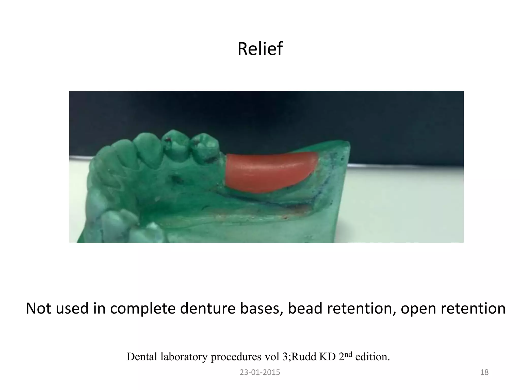 Relief
1823-01-2015
Dental laboratory procedures vol 3;Rudd KD 2nd edition.
Not used in complete denture bases, bead retention, open retention
 