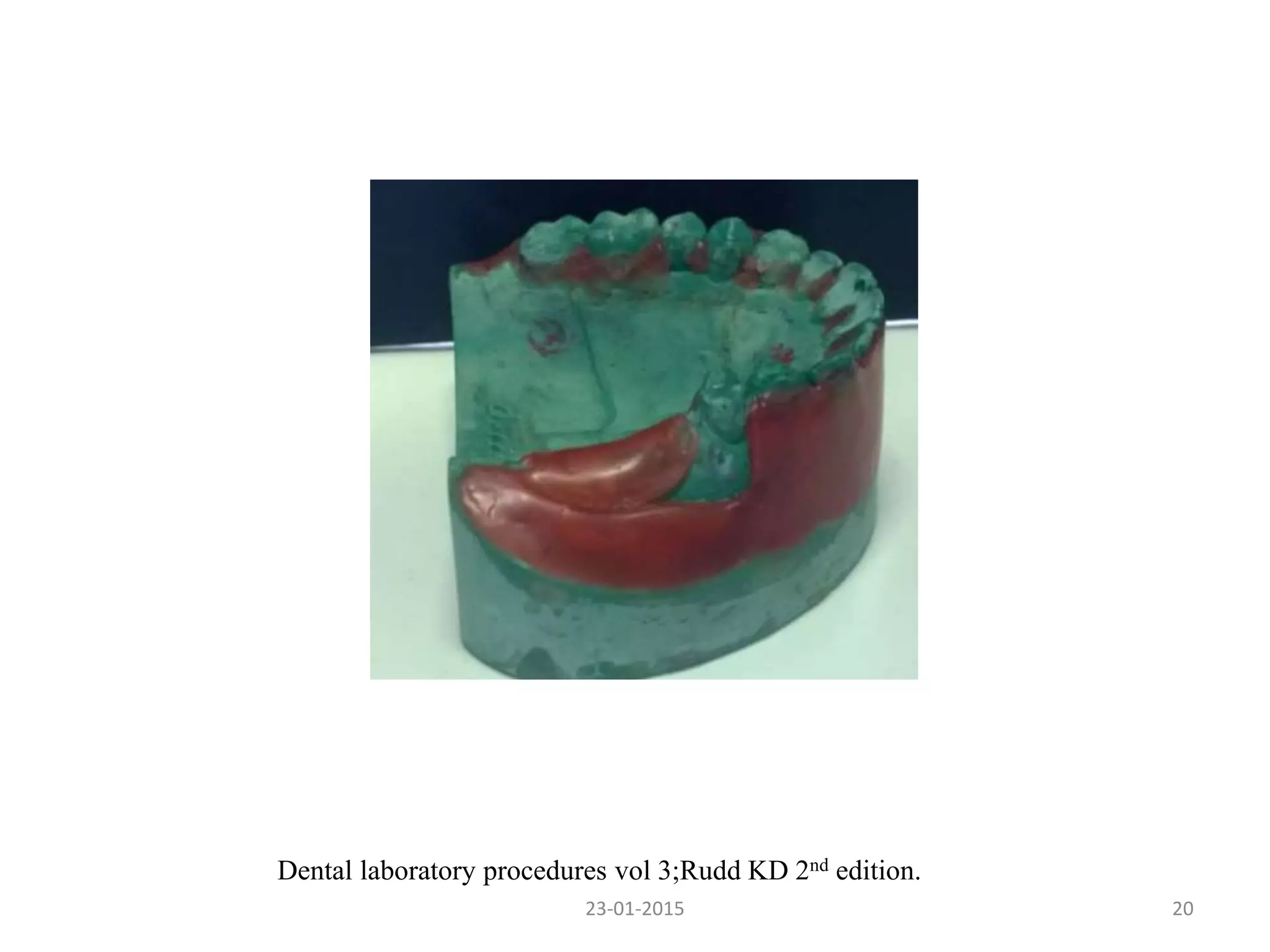 23-01-2015 20
Dental laboratory procedures vol 3;Rudd KD 2nd edition.
 