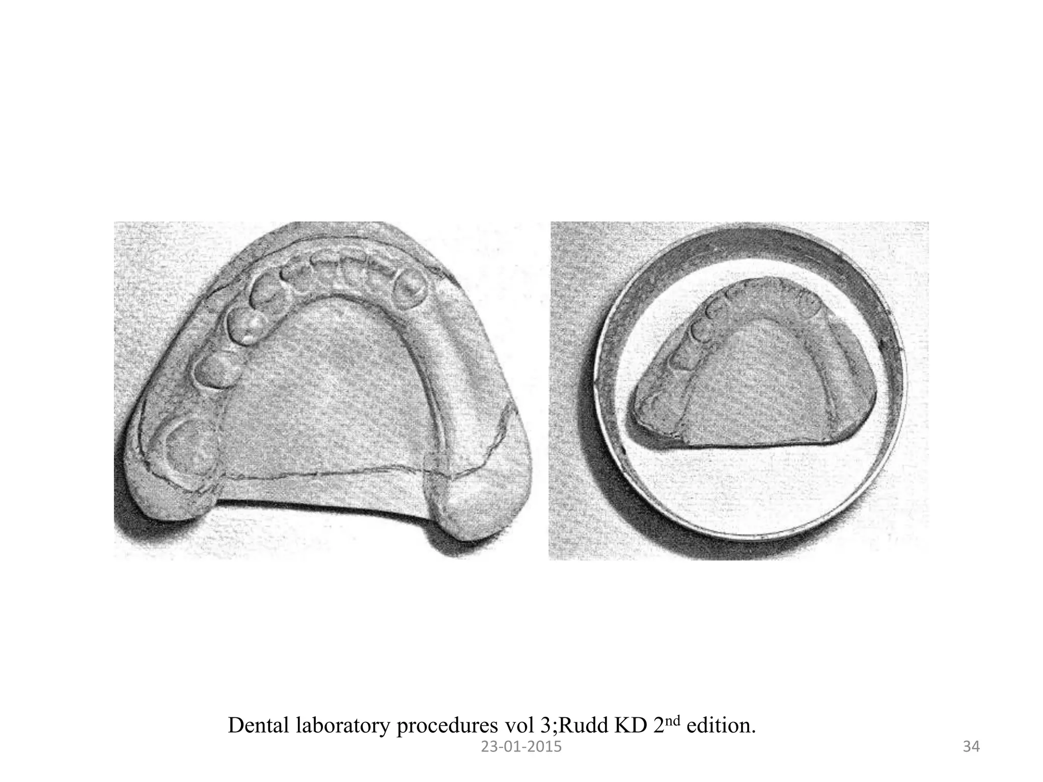 3423-01-2015
Dental laboratory procedures vol 3;Rudd KD 2nd edition.
 