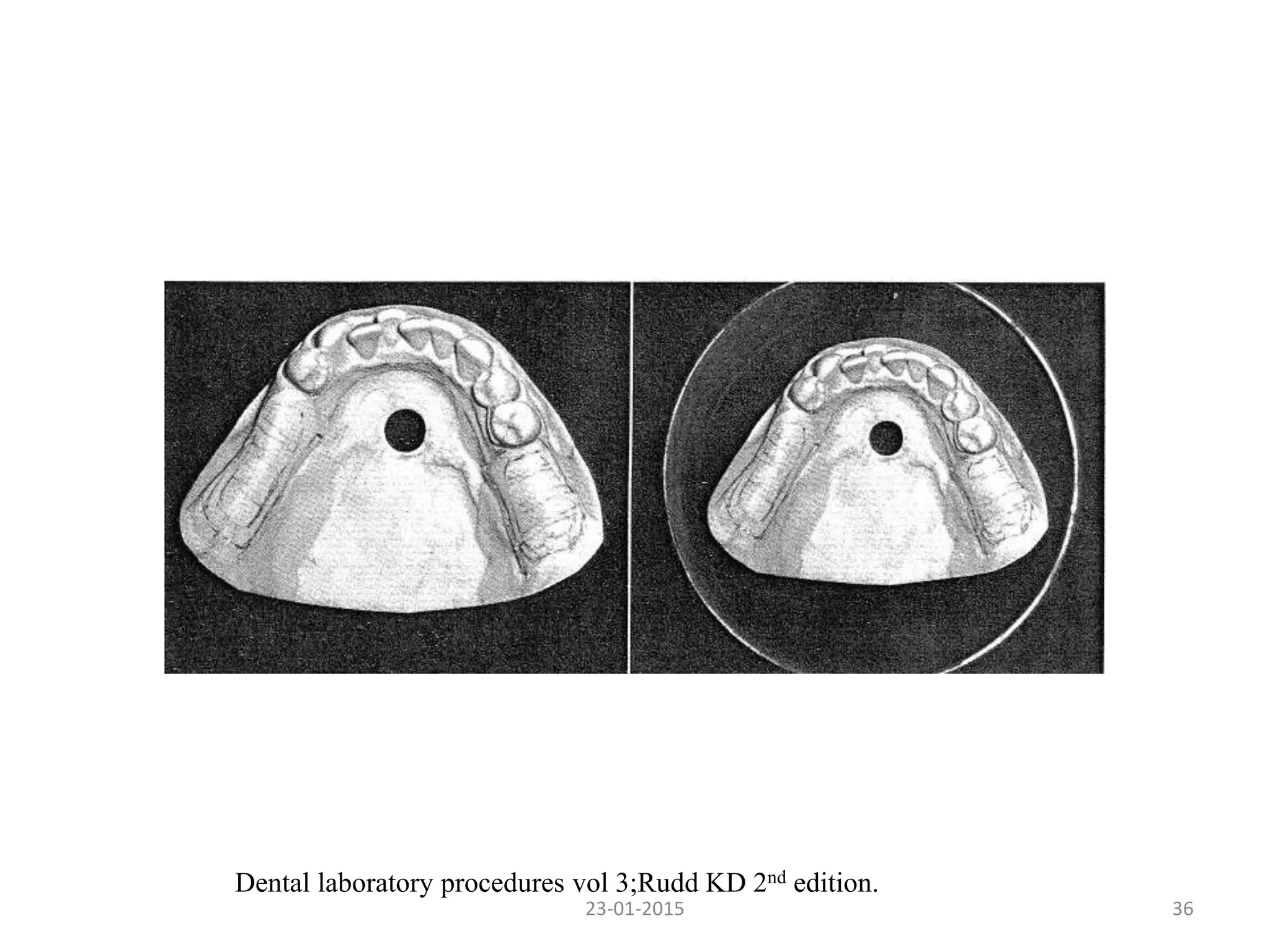 3623-01-2015
Dental laboratory procedures vol 3;Rudd KD 2nd edition.
 