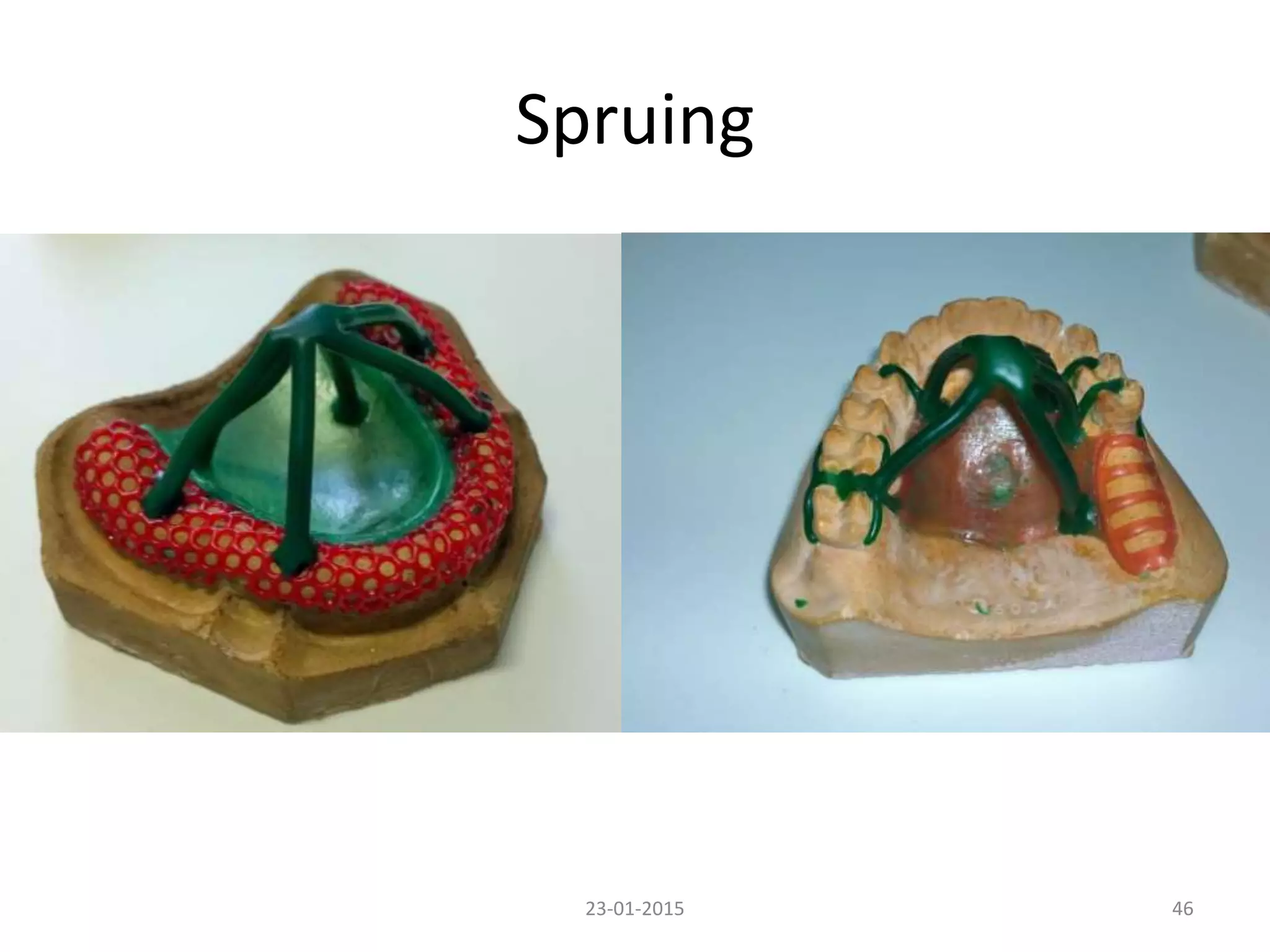 Spruing
4623-01-2015
 