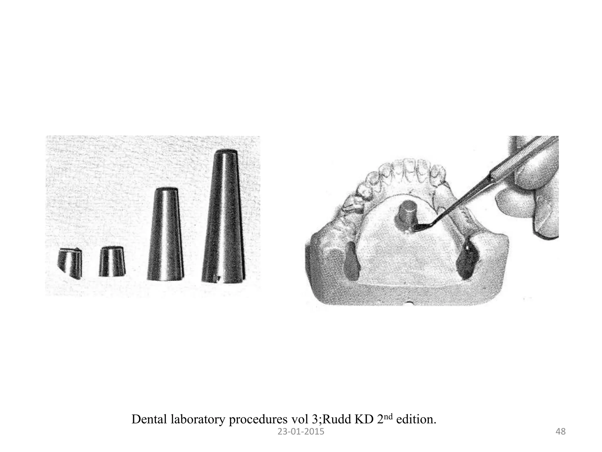4823-01-2015
Dental laboratory procedures vol 3;Rudd KD 2nd edition.
 