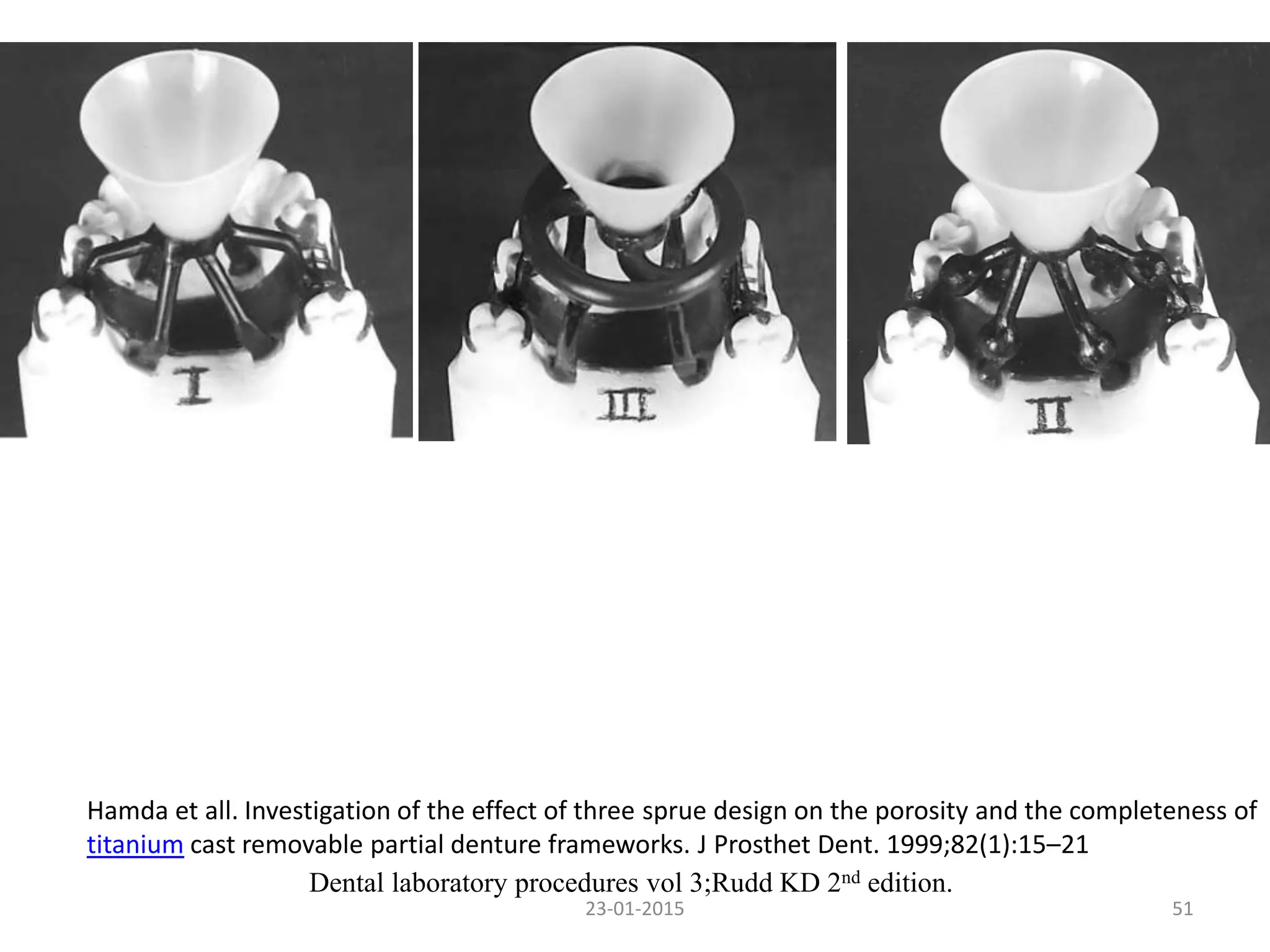 5123-01-2015
Dental laboratory procedures vol 3;Rudd KD 2nd edition.
Hamda et all. Investigation of the effect of three sprue design on the porosity and the completeness of
titanium cast removable partial denture frameworks. J Prosthet Dent. 1999;82(1):15–21
 