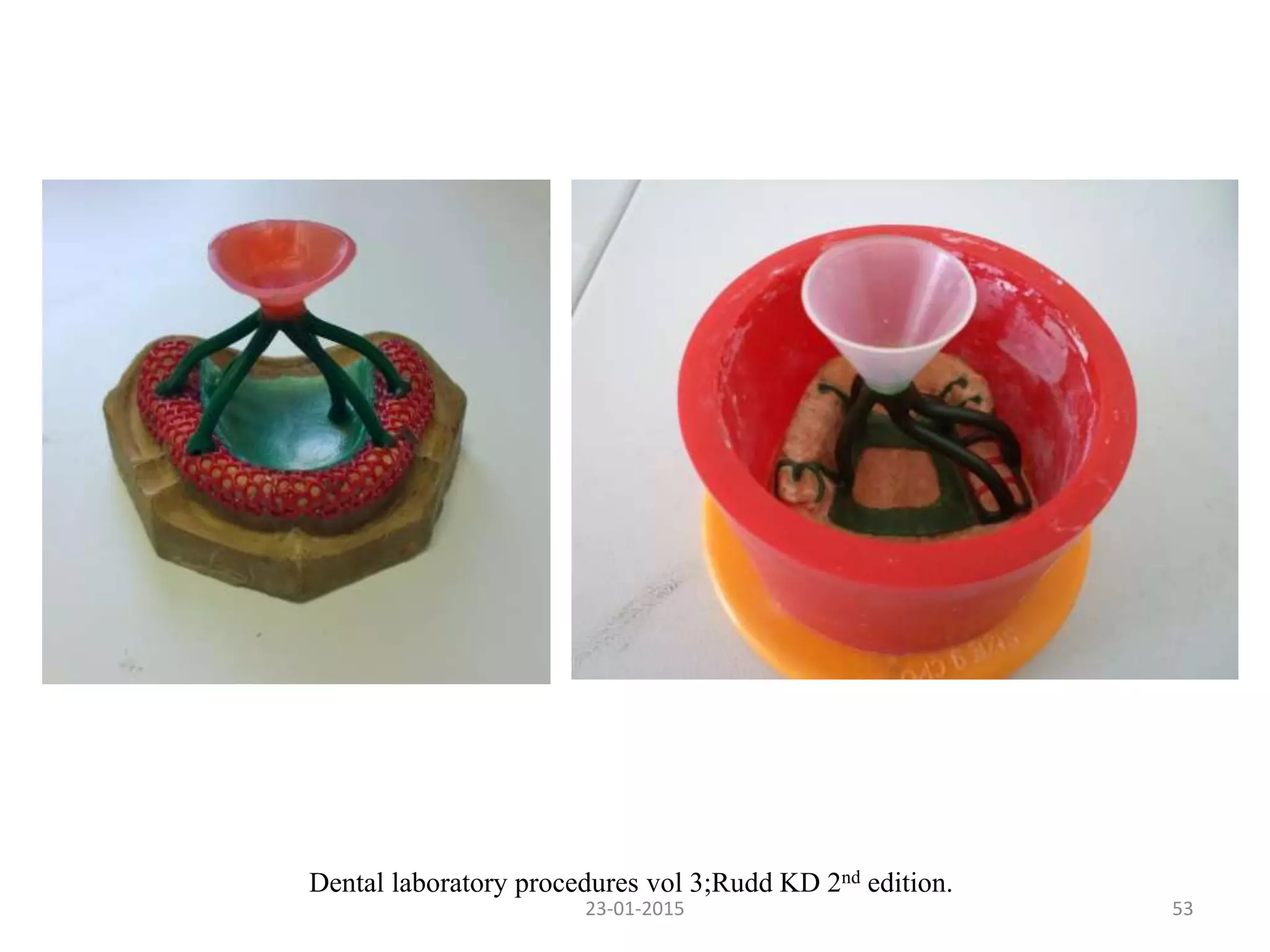 23-01-2015 53
Dental laboratory procedures vol 3;Rudd KD 2nd edition.
 