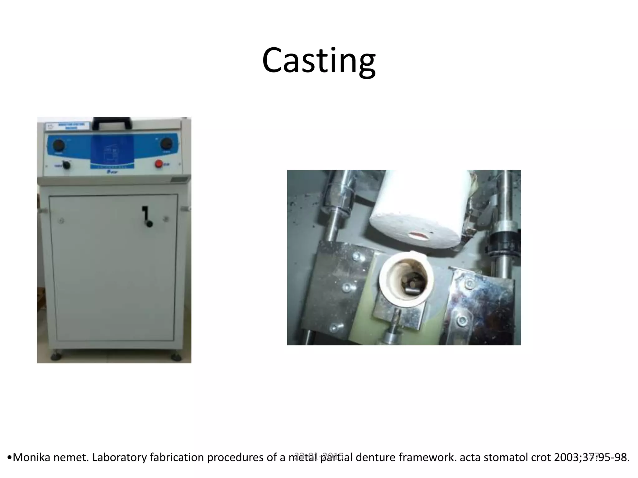 Casting
•Monika nemet. Laboratory fabrication procedures of a metal partial denture framework. acta stomatol crot 2003;37:95-98.5723-01-2015
 