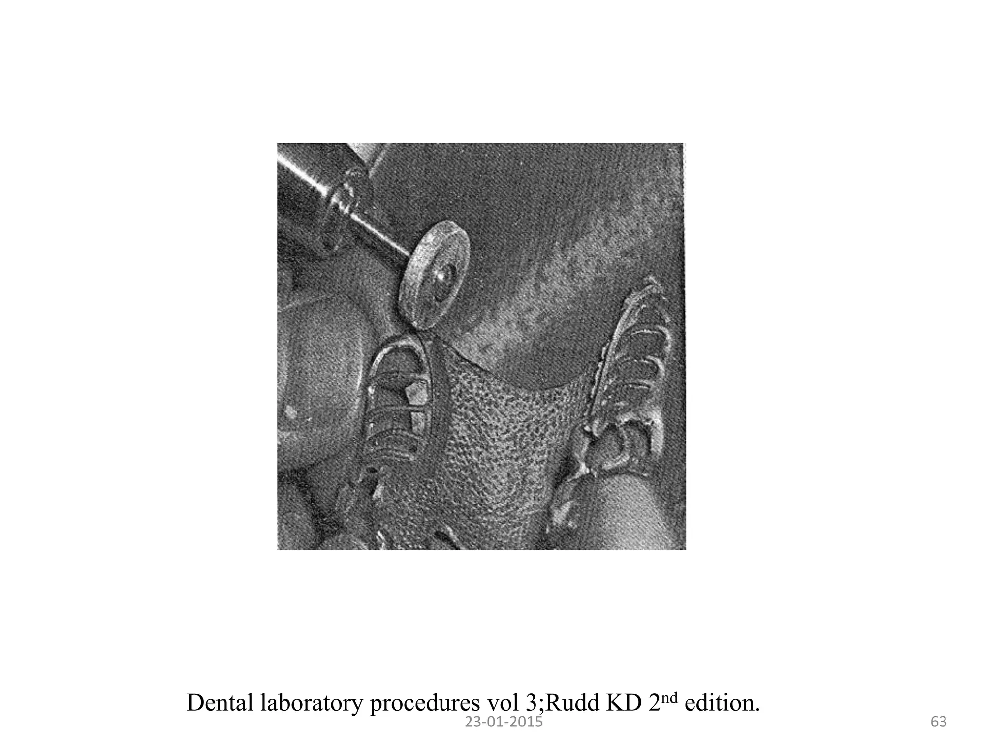 6323-01-2015
Dental laboratory procedures vol 3;Rudd KD 2nd edition.
 