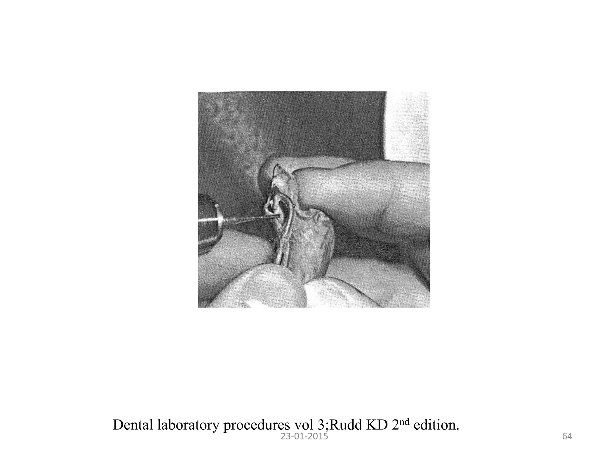 6423-01-2015
Dental laboratory procedures vol 3;Rudd KD 2nd edition.
 