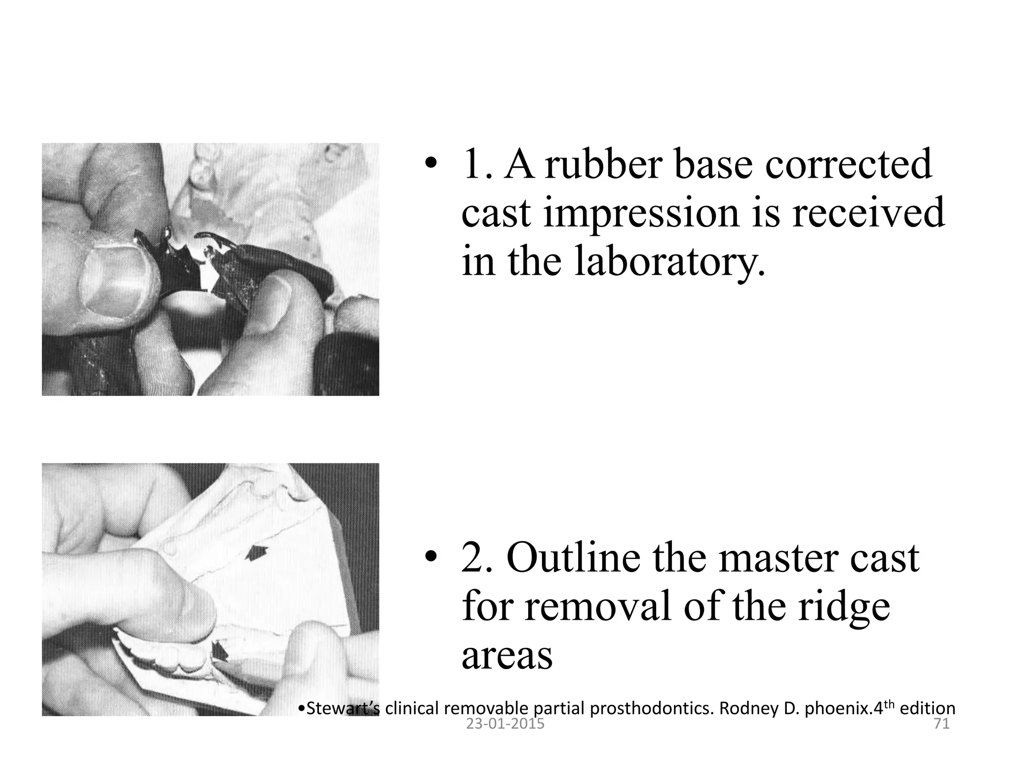 • 1. A rubber base corrected
cast impression is received
in the laboratory.
• 2. Outline the master cast
for removal of the ridge
areas
•Stewart’s clinical removable partial prosthodontics. Rodney D. phoenix.4th edition
7123-01-2015
 