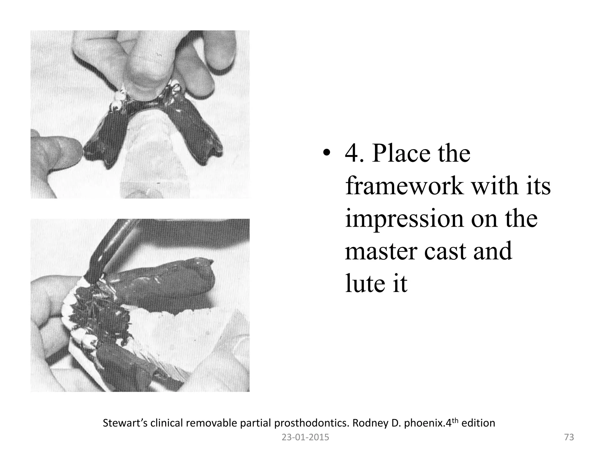 • 4. Place the
framework with its
impression on the
master cast and
lute it
Stewart’s clinical removable partial prosthodontics. Rodney D. phoenix.4th edition
7323-01-2015
 
