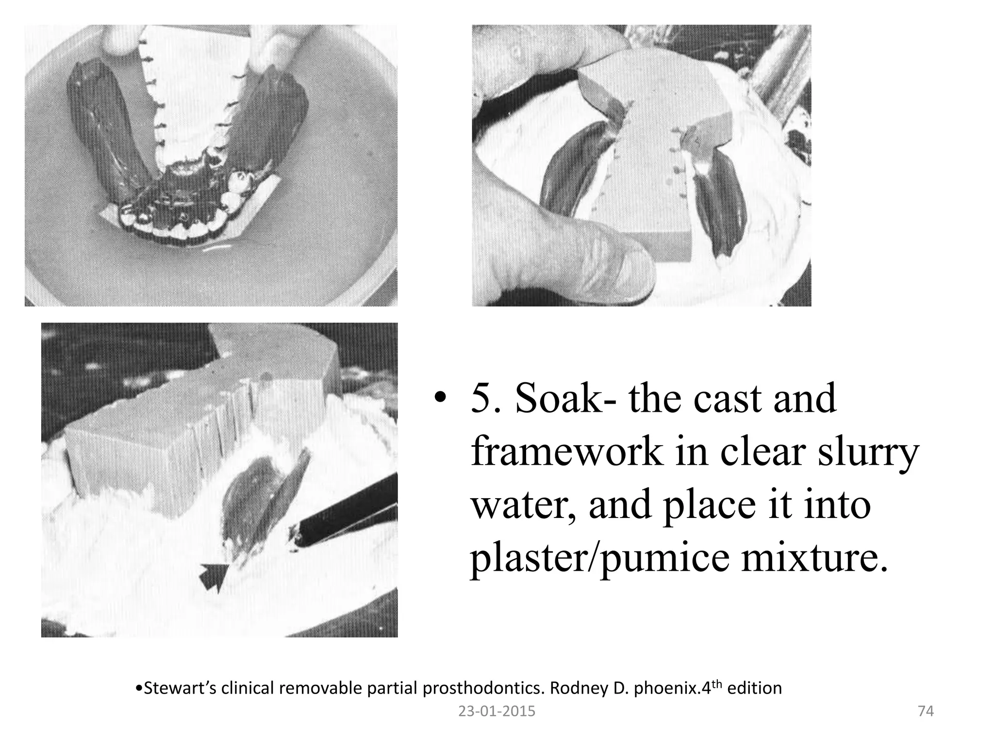 • 5. Soak- the cast and
framework in clear slurry
water, and place it into
plaster/pumice mixture.
•Stewart’s clinical removable partial prosthodontics. Rodney D. phoenix.4th edition
7423-01-2015
 