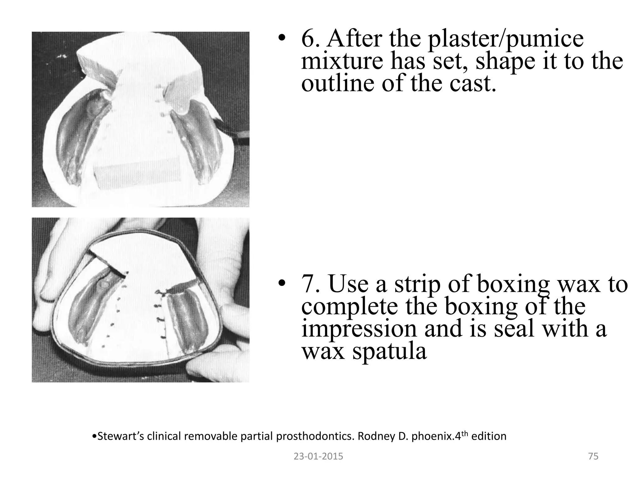 • 6. After the plaster/pumice
mixture has set, shape it to the
outline of the cast.
• 7. Use a strip of boxing wax to
complete the boxing of the
impression and is seal with a
wax spatula
•Stewart’s clinical removable partial prosthodontics. Rodney D. phoenix.4th edition
7523-01-2015
 