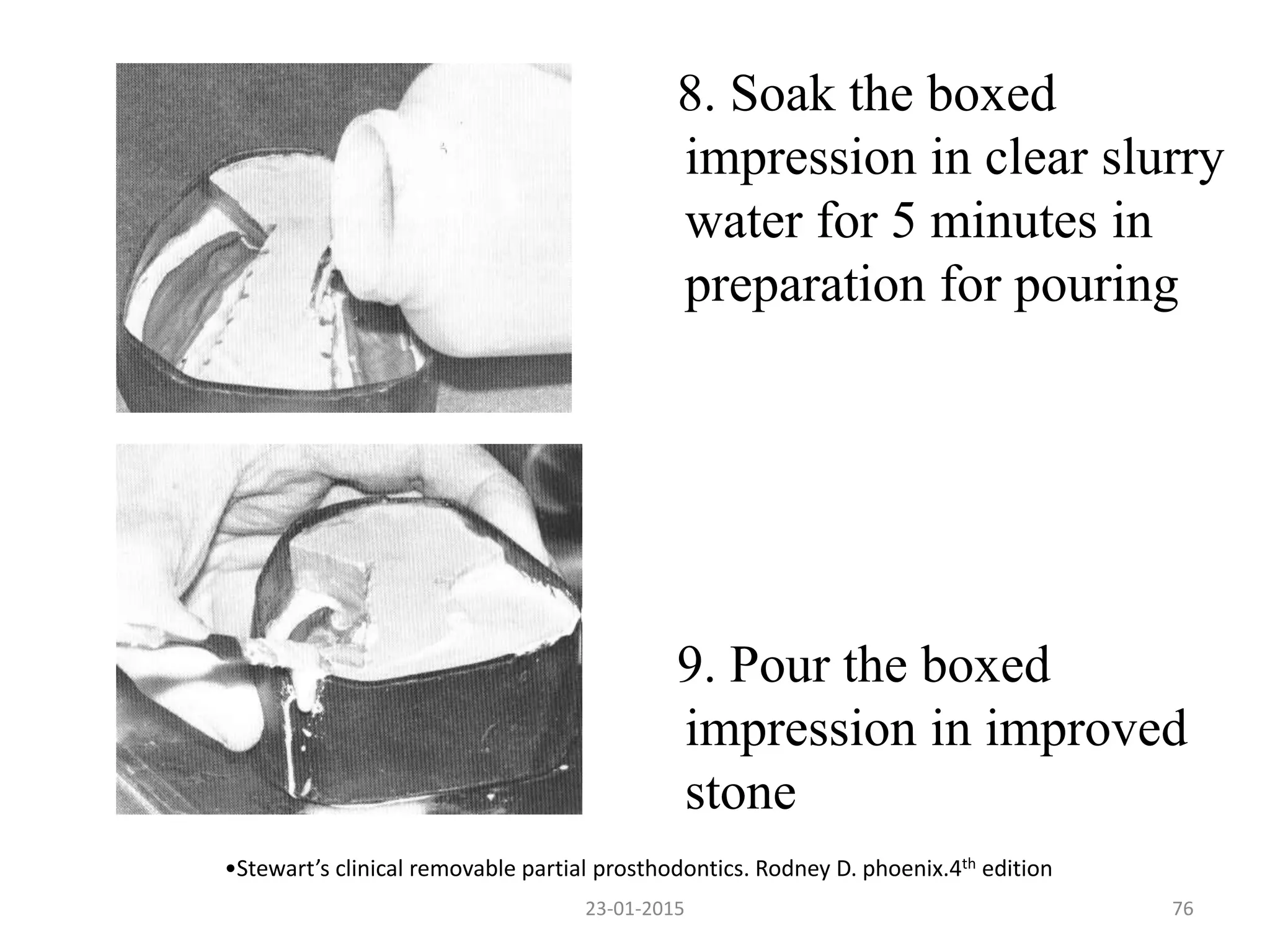 8. Soak the boxed
impression in clear slurry
water for 5 minutes in
preparation for pouring
9. Pour the boxed
impression in improved
stone
•Stewart’s clinical removable partial prosthodontics. Rodney D. phoenix.4th edition
7623-01-2015
 