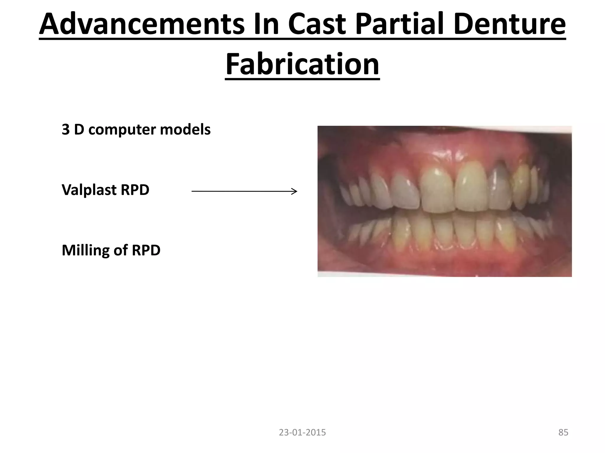 Advancements In Cast Partial Denture
Fabrication
23-01-2015 85
3 D computer models
Valplast RPD
Milling of RPD
 