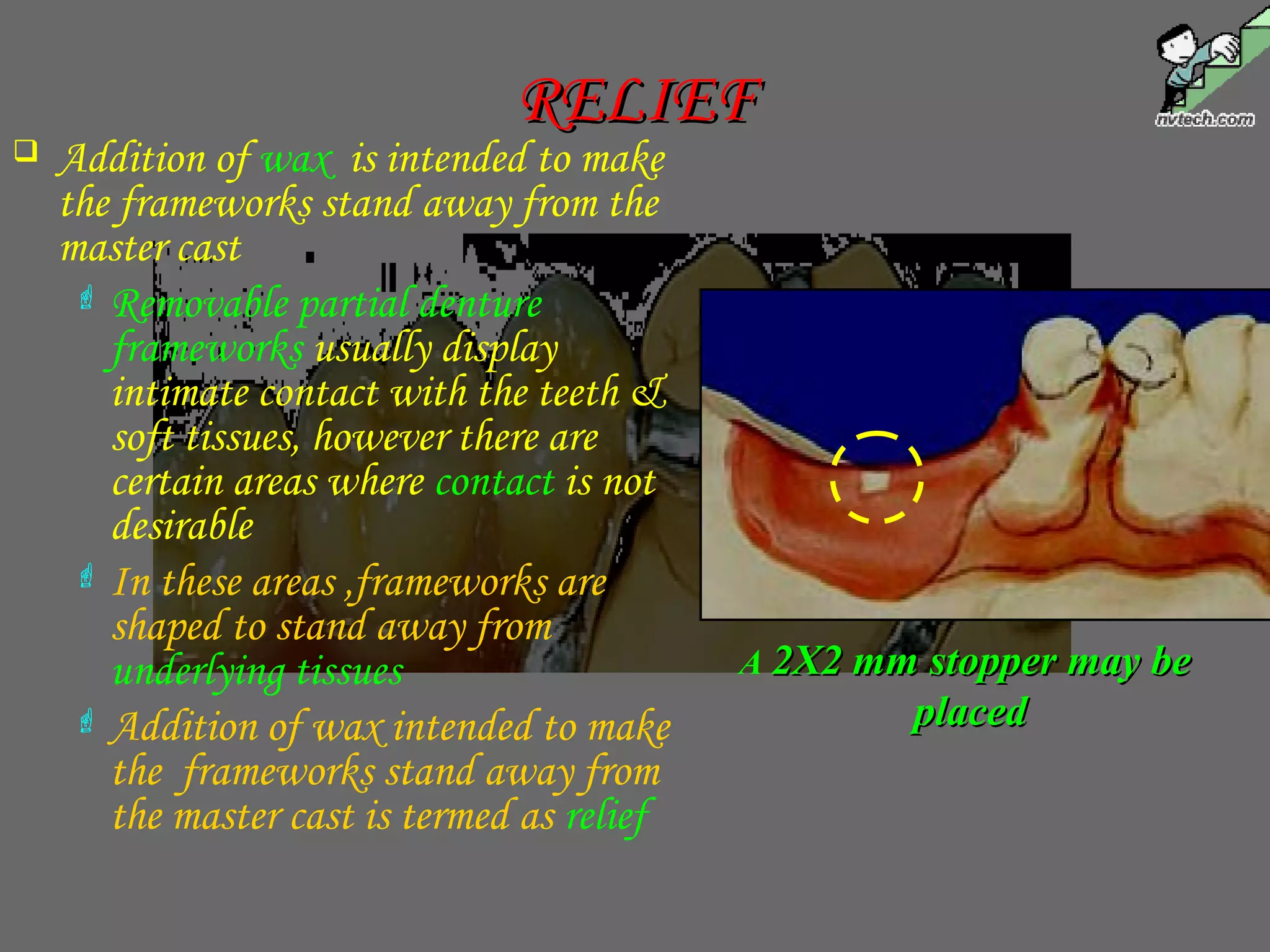  Addition of wax is intended to make
the frameworks stand away from the
master cast
 Removable partial denture
frameworks usually display
intimate contact with the teeth &
soft tissues, however there are
certain areas where contact is not
desirable
 In these areas ,frameworks are
shaped to stand away from
underlying tissues
 Addition of wax intended to make
the frameworks stand away from
the master cast is termed as relief
A 2X2 mm stopper may be2X2 mm stopper may be
placedplaced
RELIEFRELIEF
 