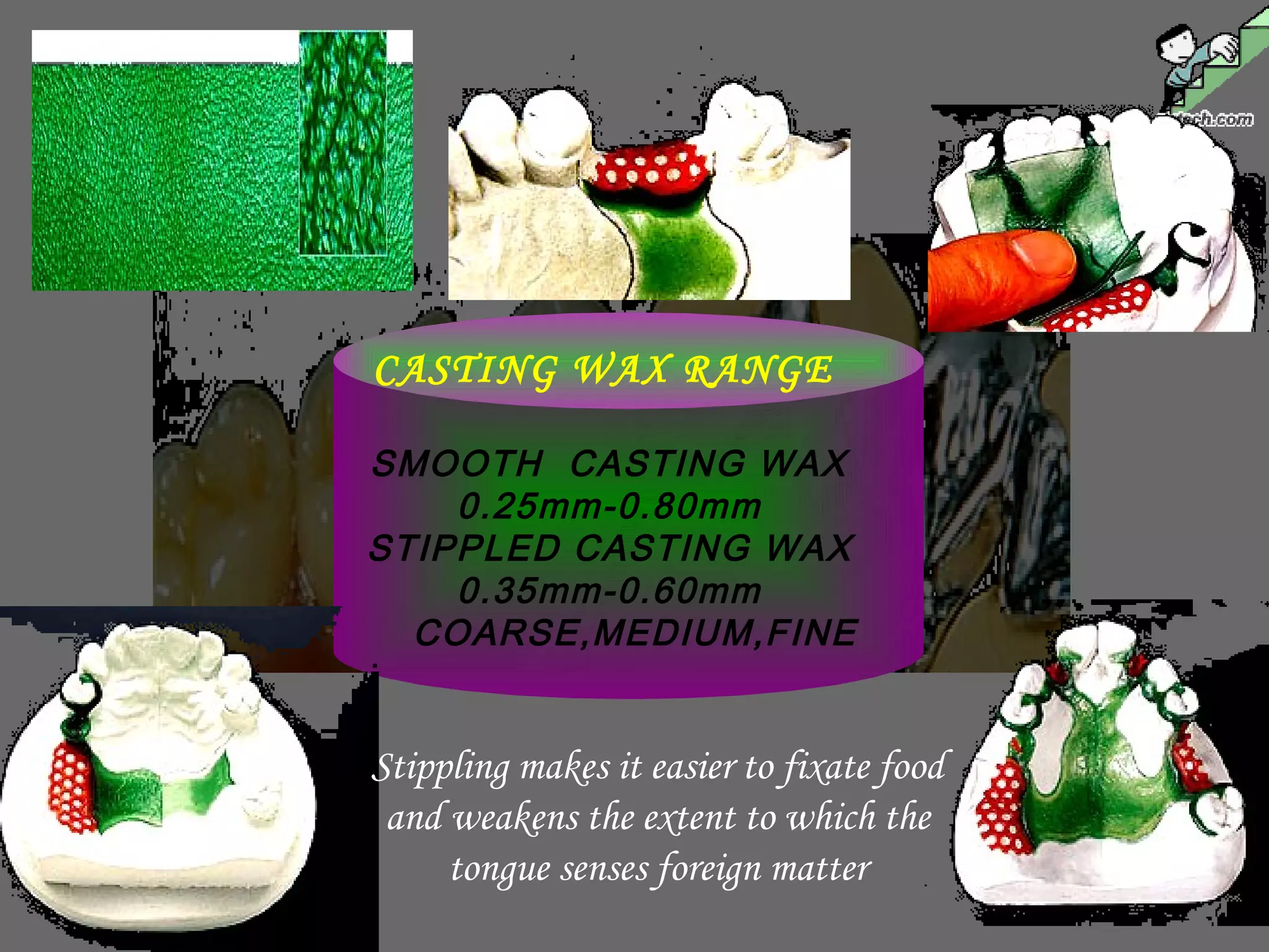 Stippling makes it easier to fixate food
and weakens the extent to which the
tongue senses foreign matter
CASTING WAX RANGE
SMOOTH CASTING WAX
0.25mm-0.80mm
STIPPLED CASTING WAX
0.35mm-0.60mm
COARSE,MEDIUM,FINE
 