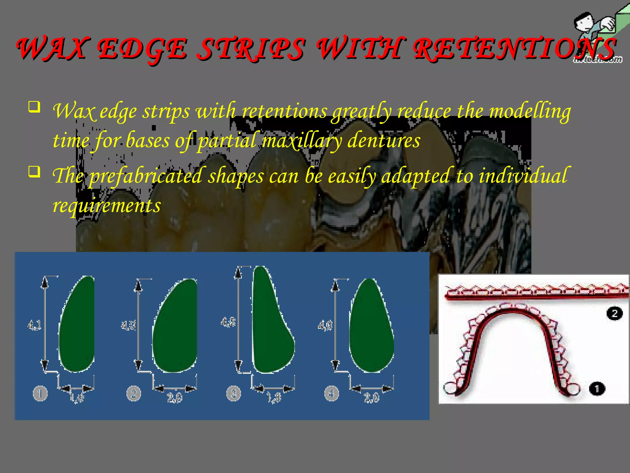  Wax edge strips with retentions greatly reduce the modelling
time for bases of partial maxillary dentures
 The prefabricated shapes can be easily adapted to individual
requirements
WAX EDGE STRIPS WITH RETENTIONSWAX EDGE STRIPS WITH RETENTIONS
 