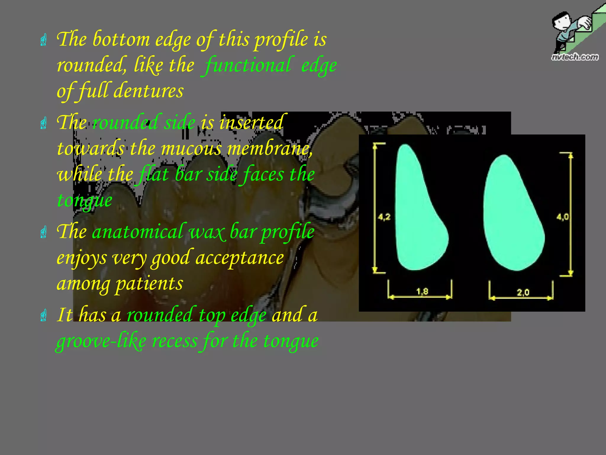  The bottom edge of this profile is
rounded, like the functional edge
of full dentures
 The rounded side is inserted
towards the mucous membrane,
while the flat bar side faces the
tongue
 The anatomical wax bar profile
enjoys very good acceptance
among patients
 It has a rounded top edge and a
groove-like recess for the tongue
 