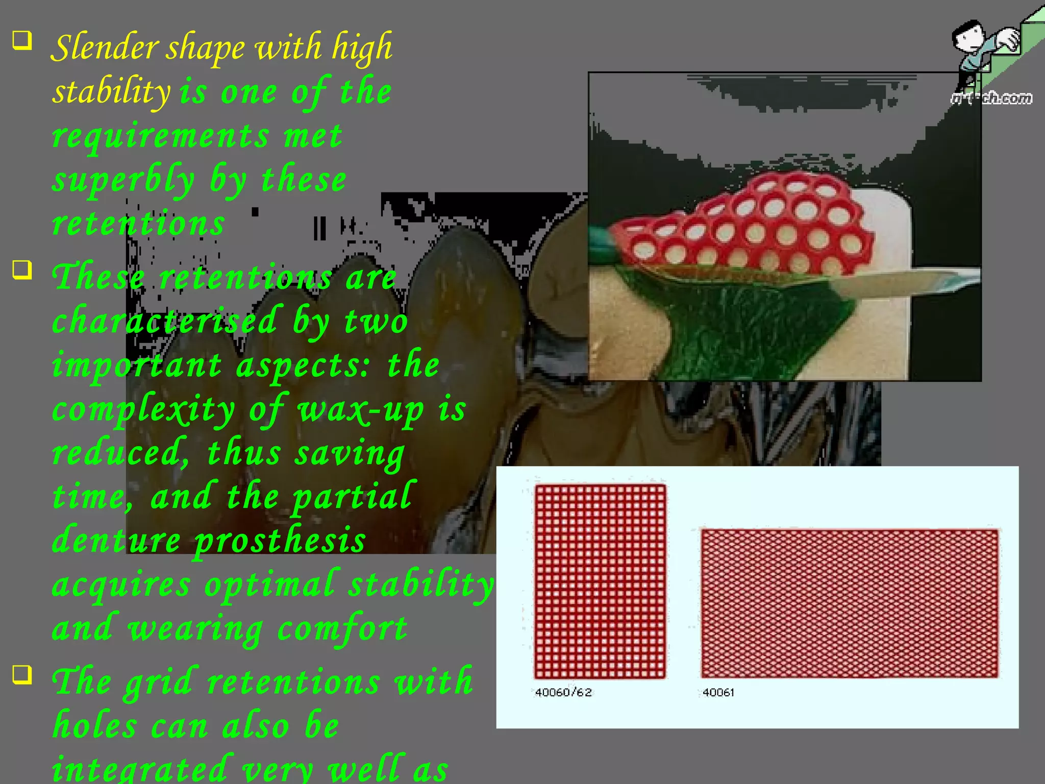  Slender shape with high
stability is one of the
requirements met
superbly by these
retentions
 These retentions are
characterised by two
important aspects: the
complexity of wax-up is
reduced, thus saving
time, and the partial
denture prosthesis
acquires optimal stability
and wearing comfort
 The grid retentions with
holes can also be
integrated very well as
 