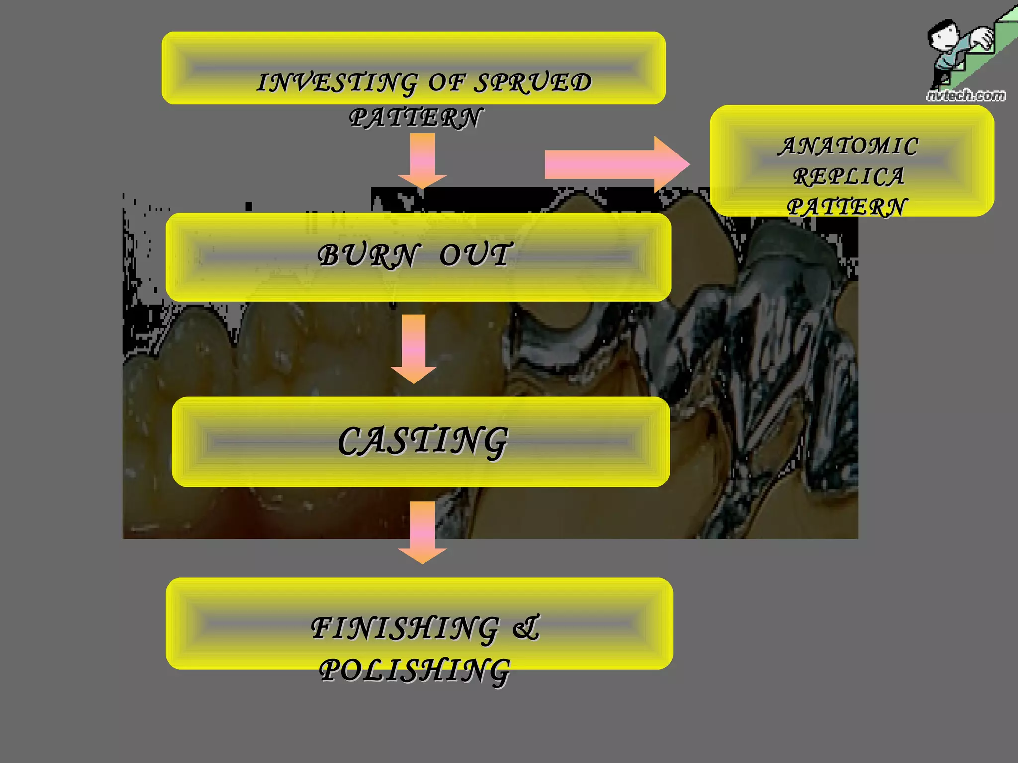 INVESTING OF SPRUEDINVESTING OF SPRUED
PATTERNPATTERN
BURN OUTBURN OUT
CASTINGCASTING
FINISHING &FINISHING &
POLISHINGPOLISHING
ANATOMICANATOMIC
REPLICAREPLICA
PATTERNPATTERN
 